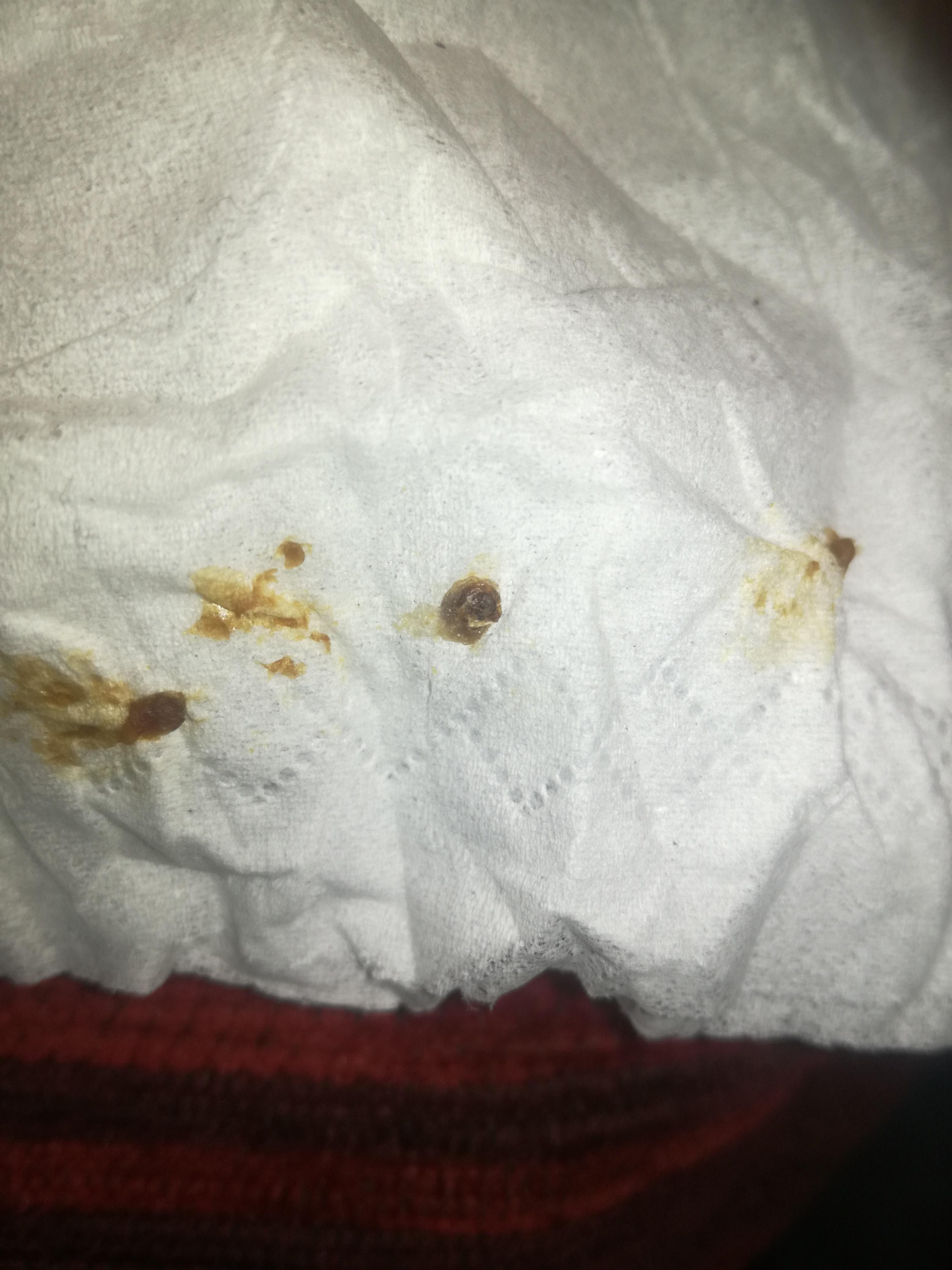 Question details sensitive content