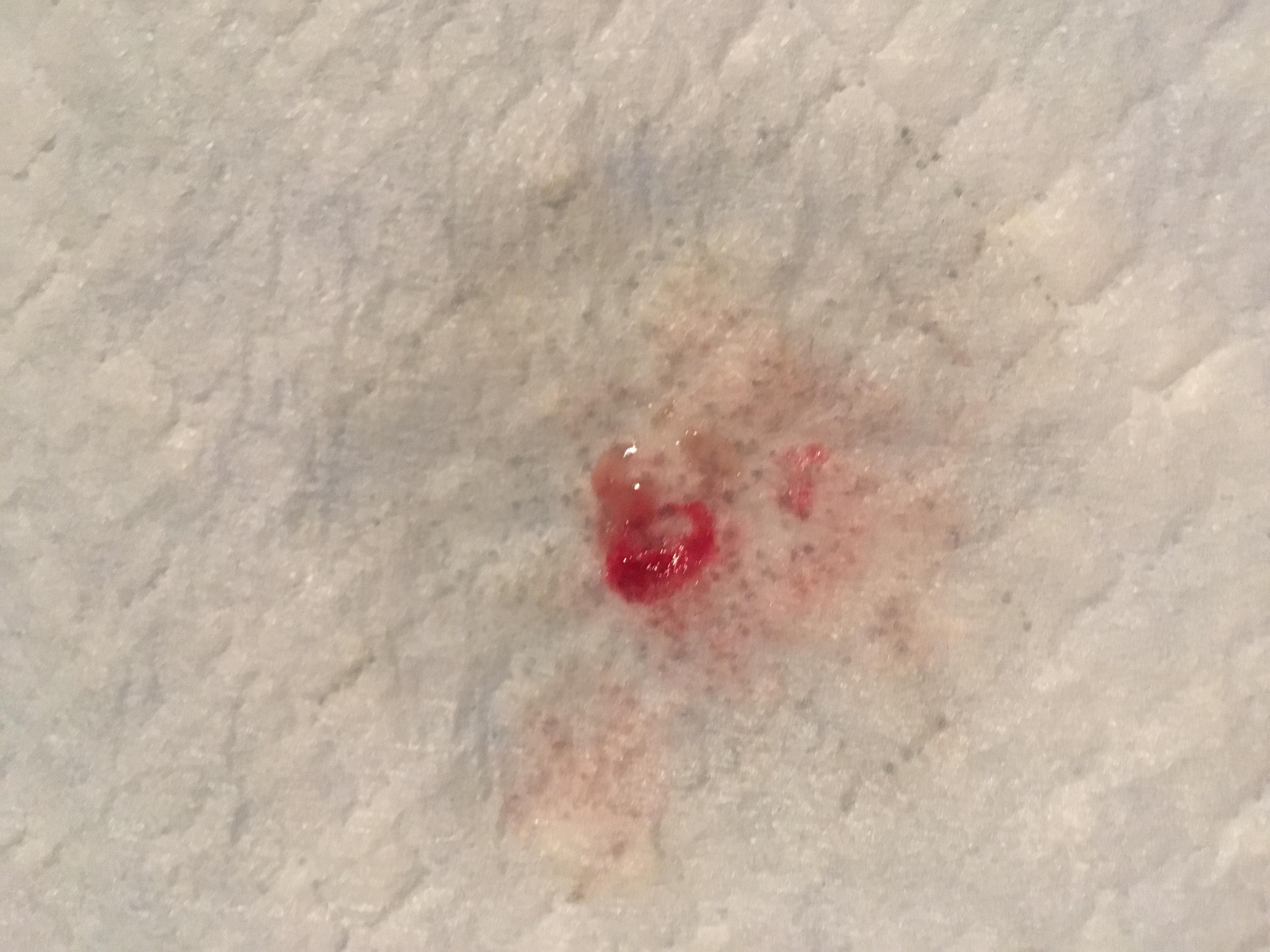 Question details sensitive content