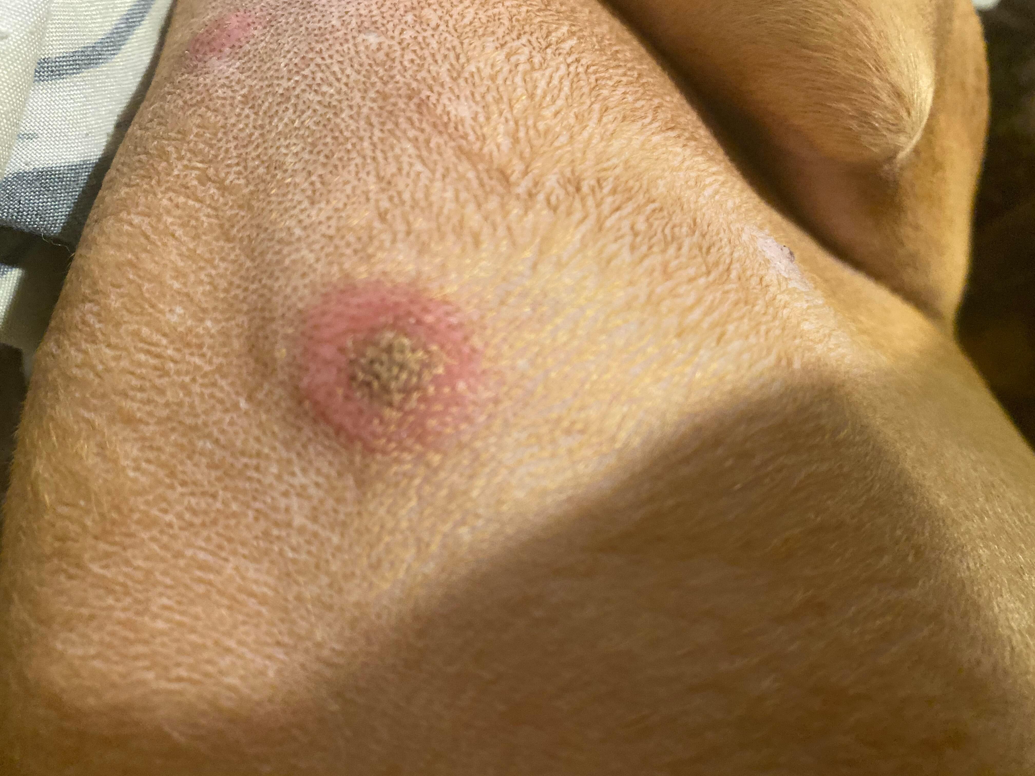 Question details sensitive content