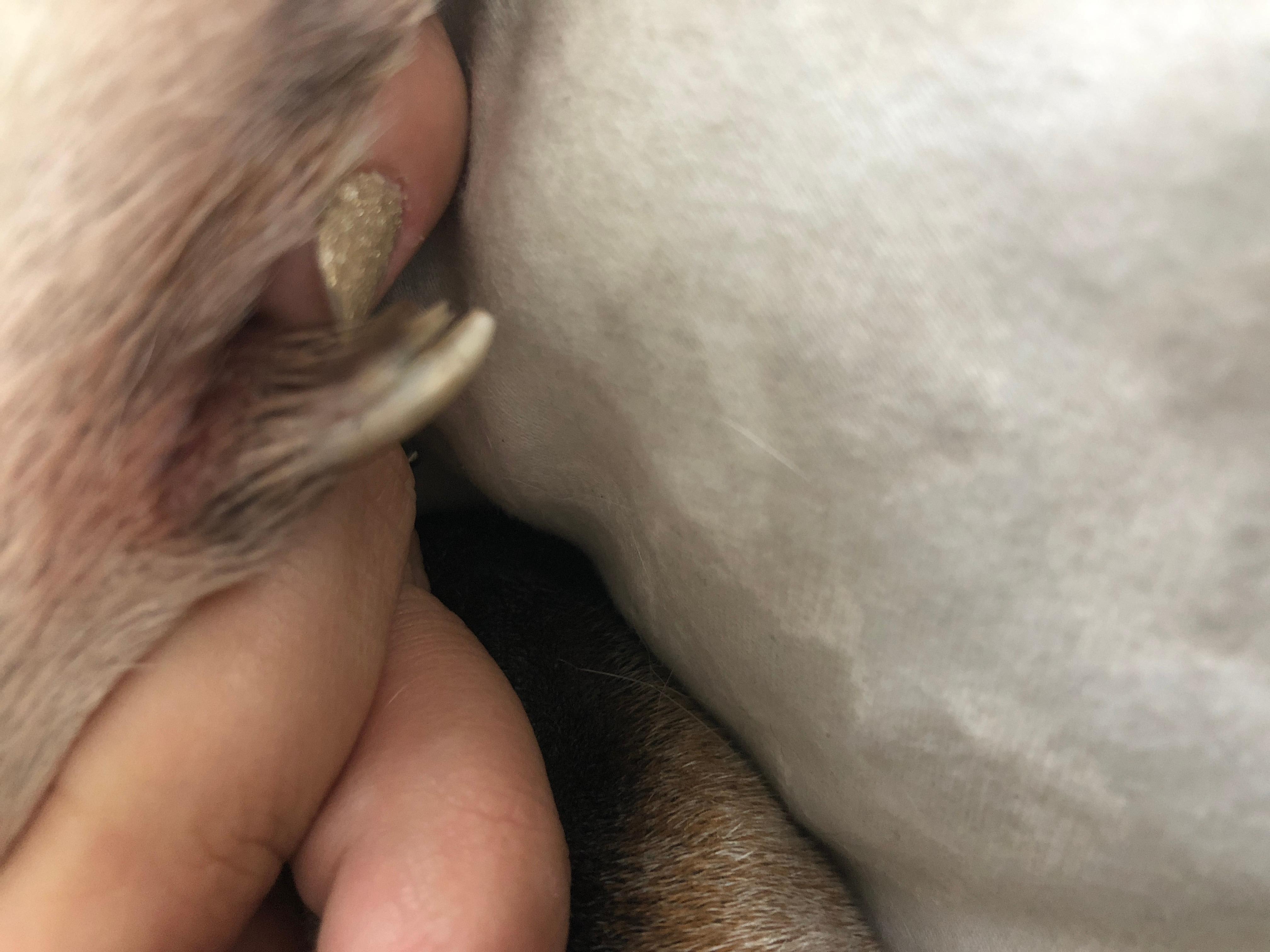 Question details sensitive content