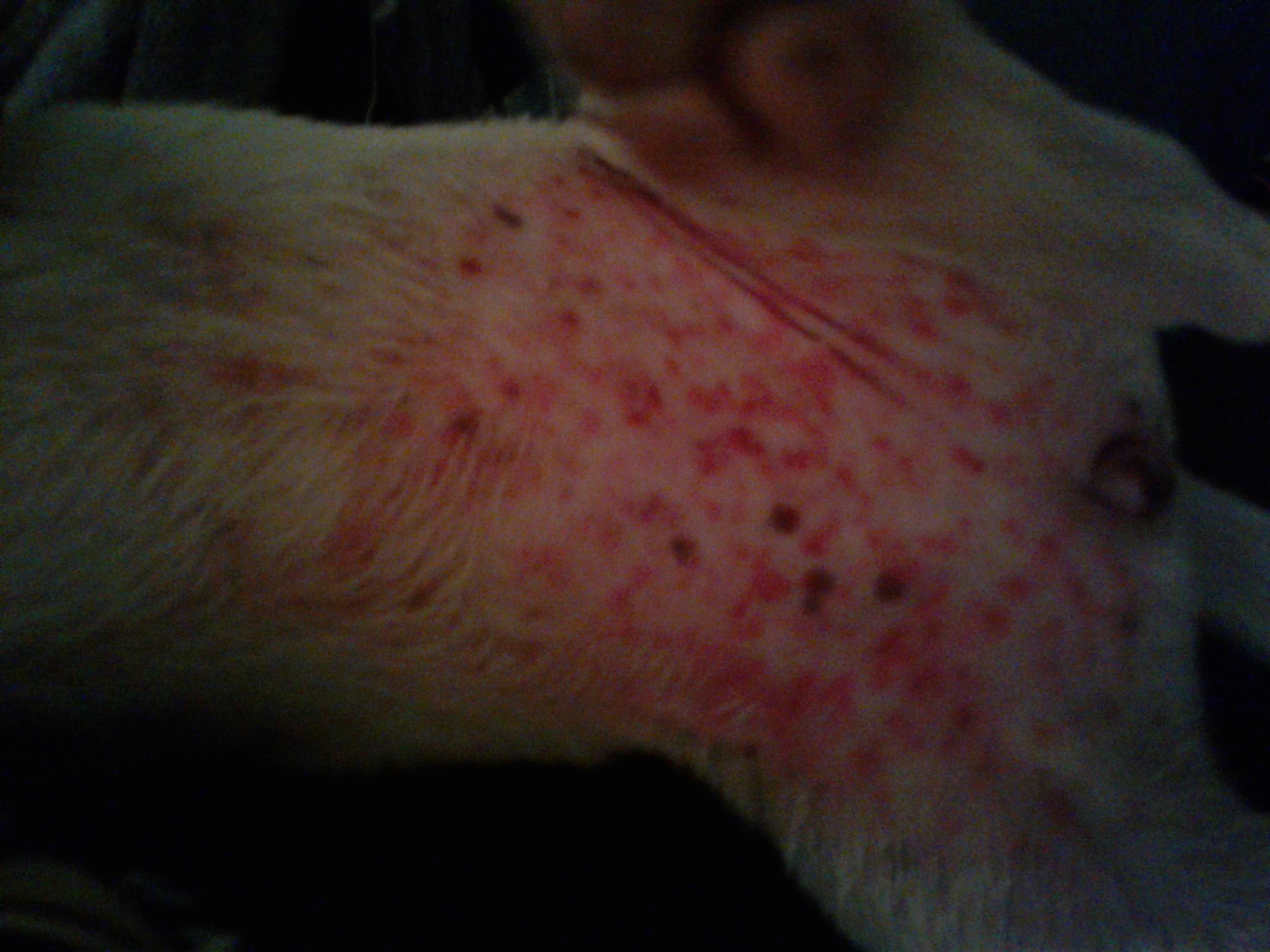 Question details sensitive content