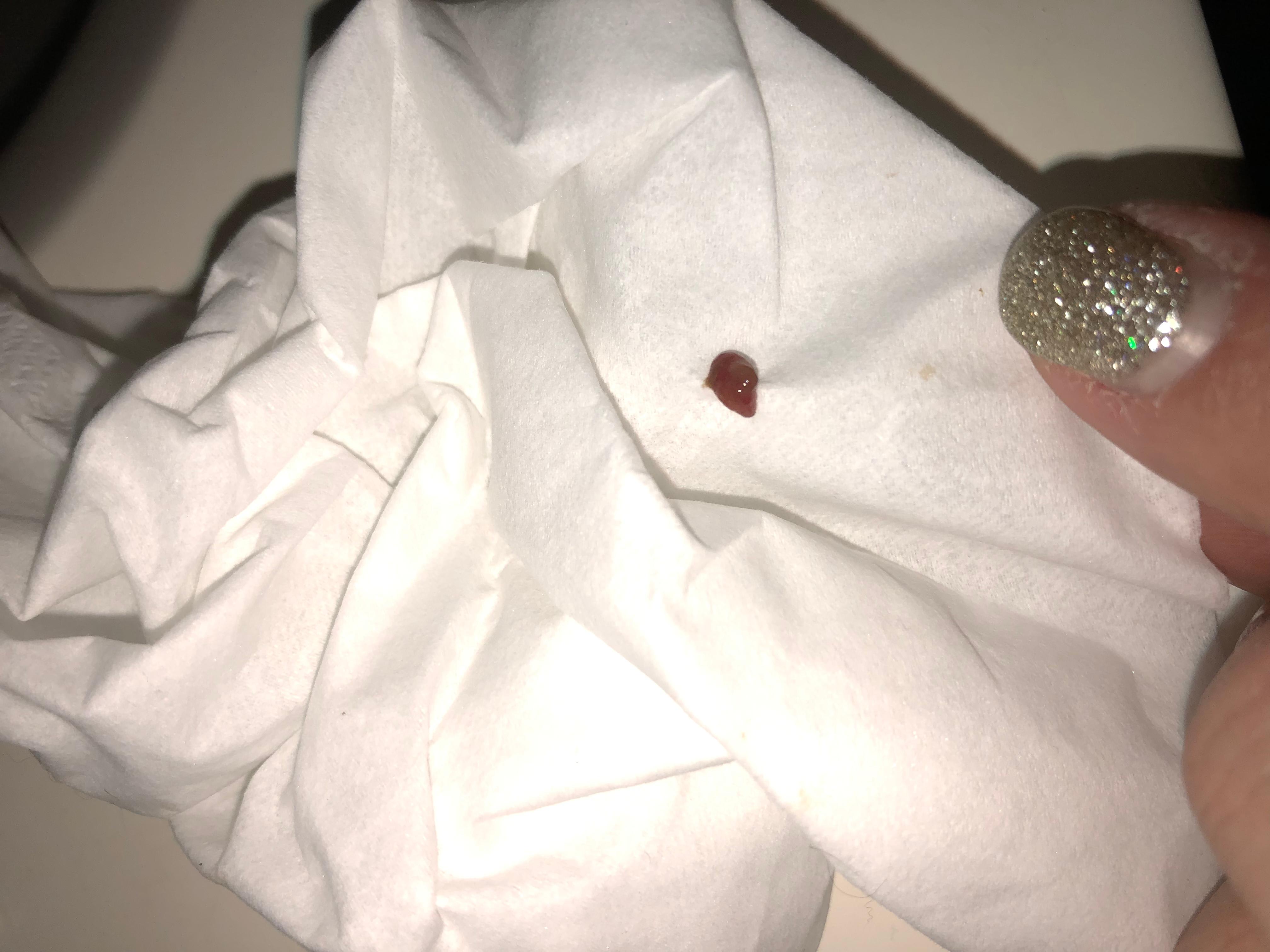 Question details sensitive content