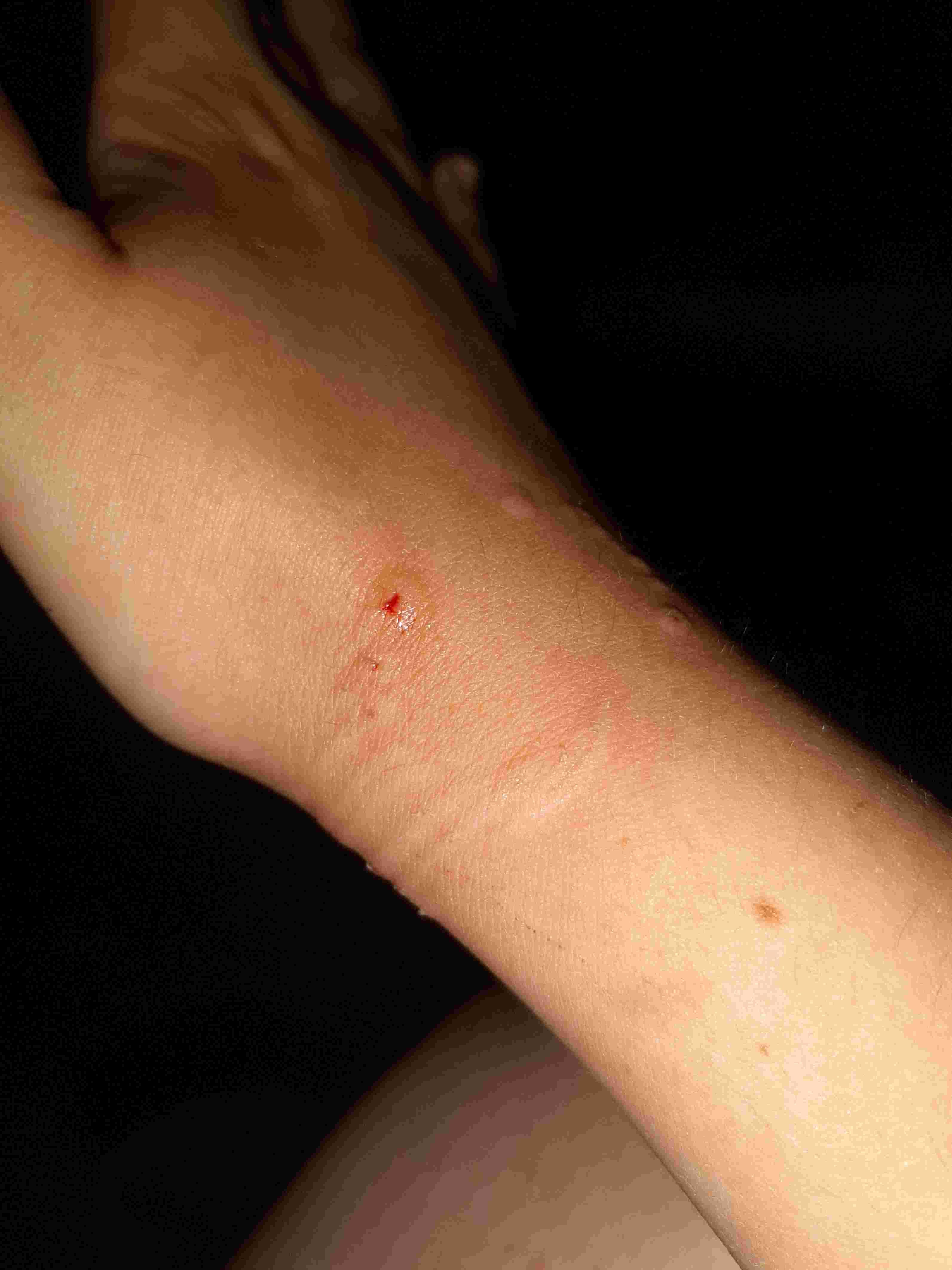 Question details sensitive content