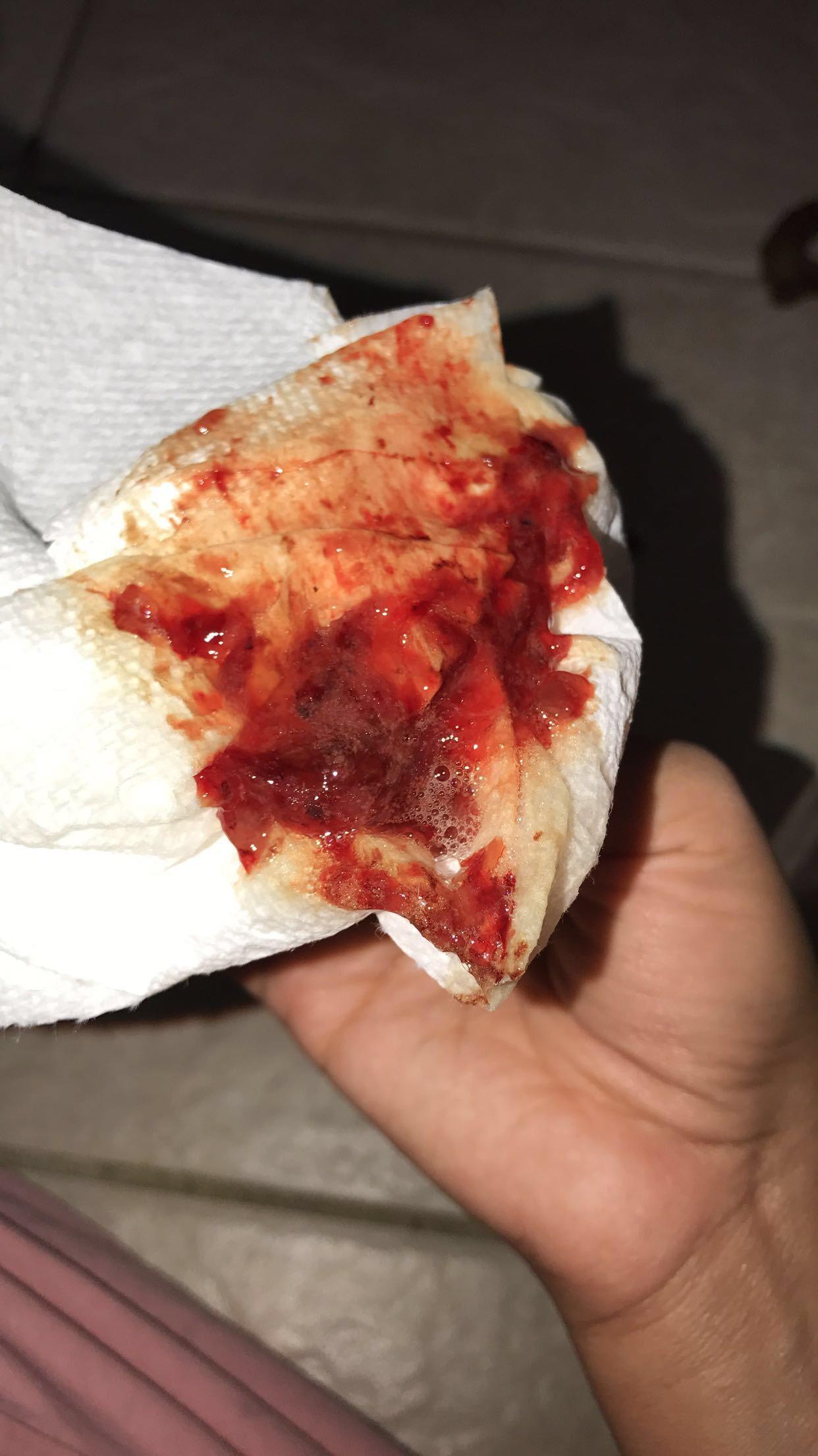 Question details sensitive content