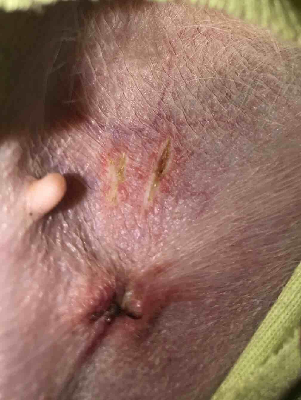 Question details sensitive content