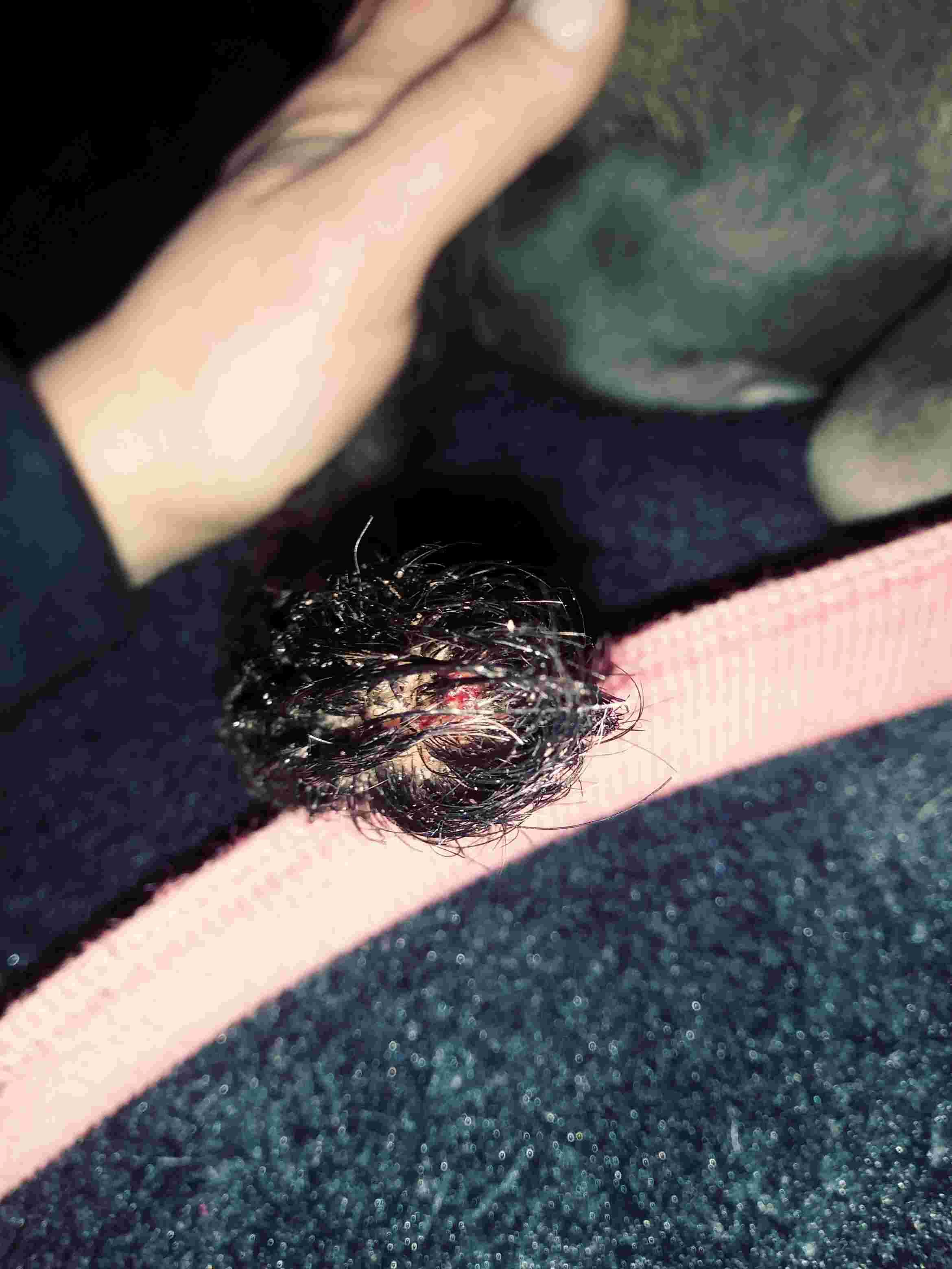 Question details sensitive content