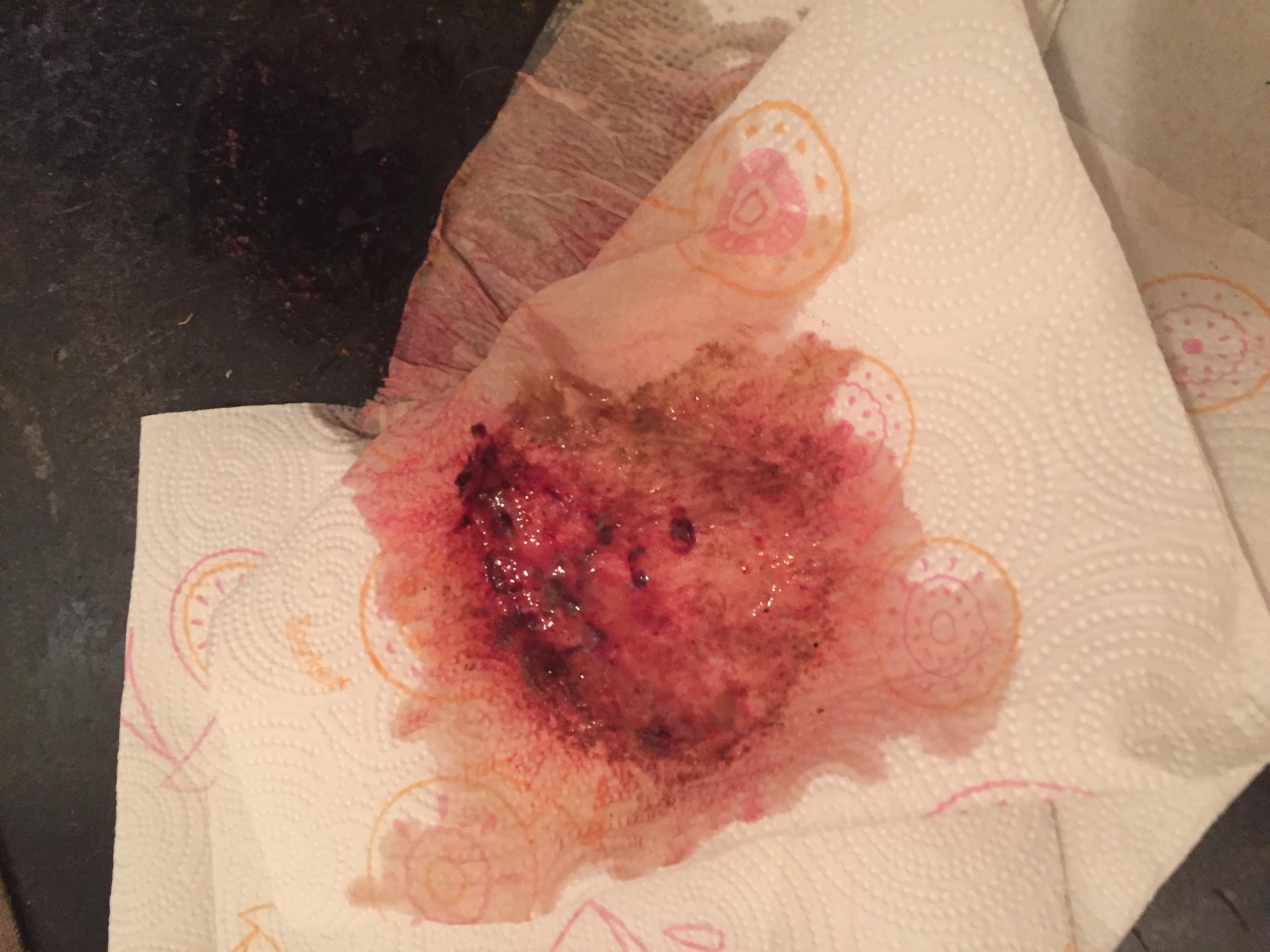 Question details sensitive content