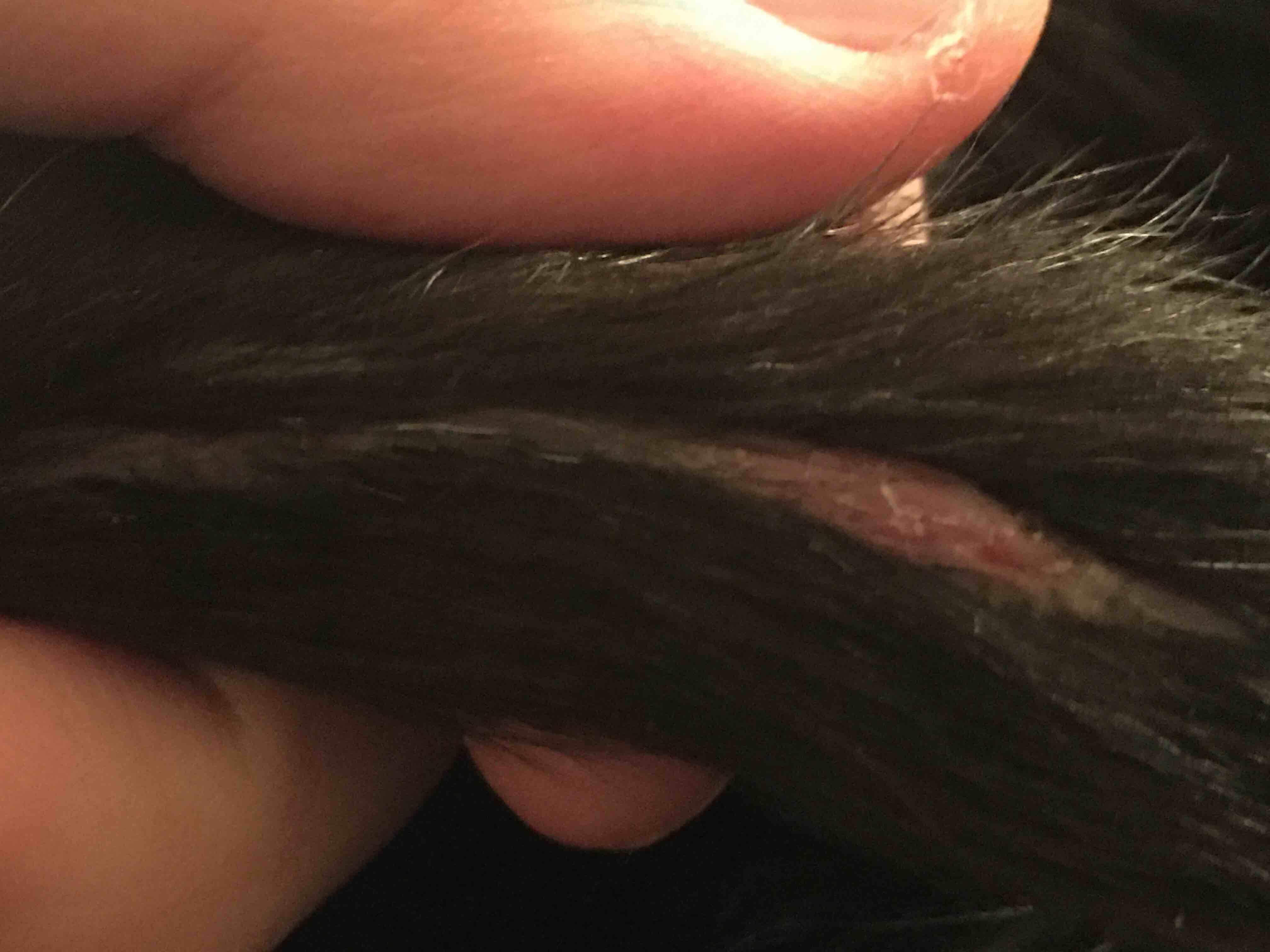 Question details sensitive content