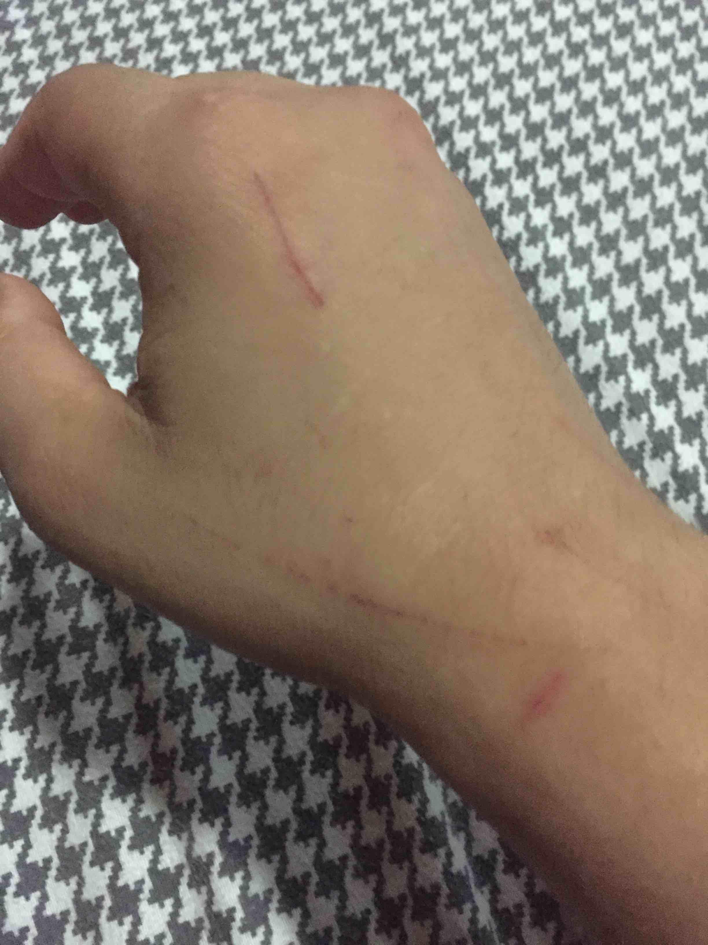 Question details sensitive content