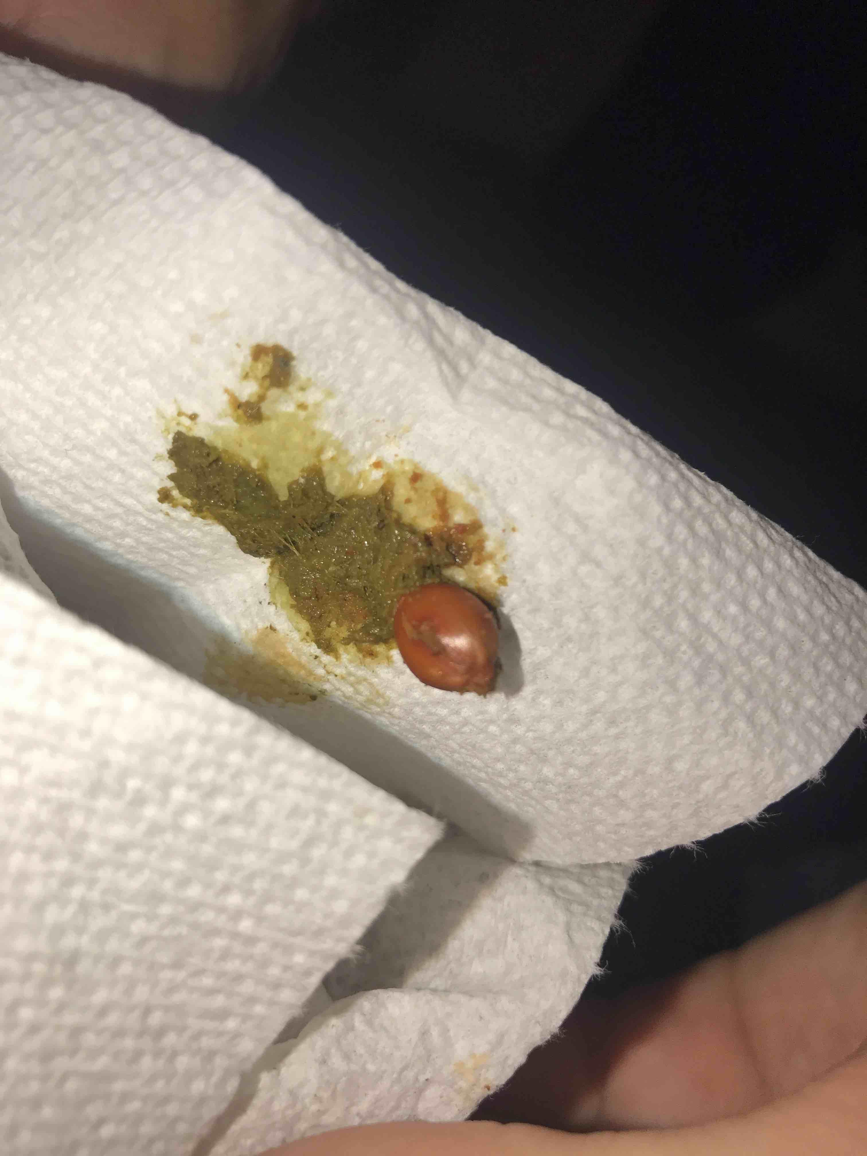 Question details sensitive content