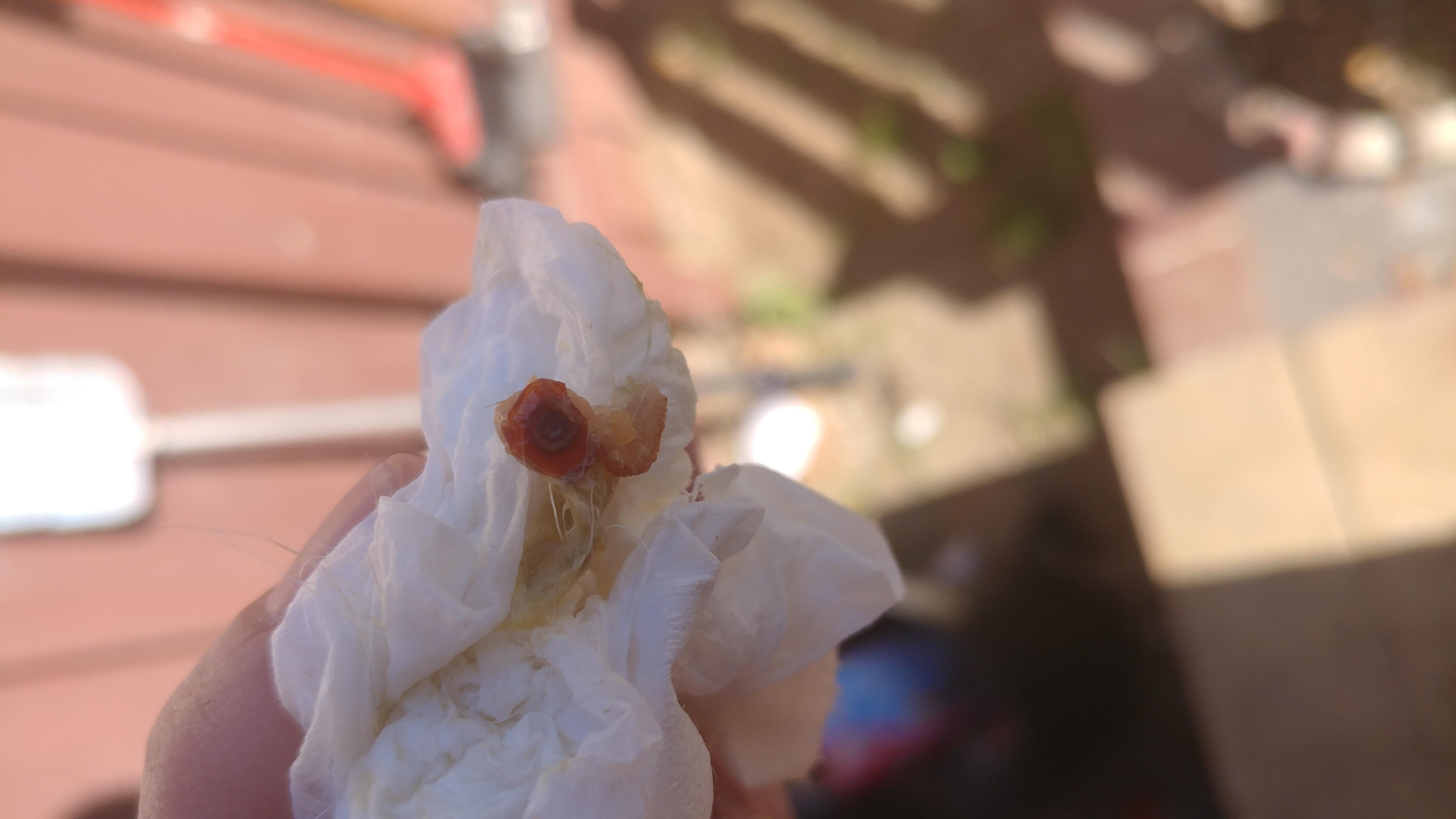 Question details sensitive content