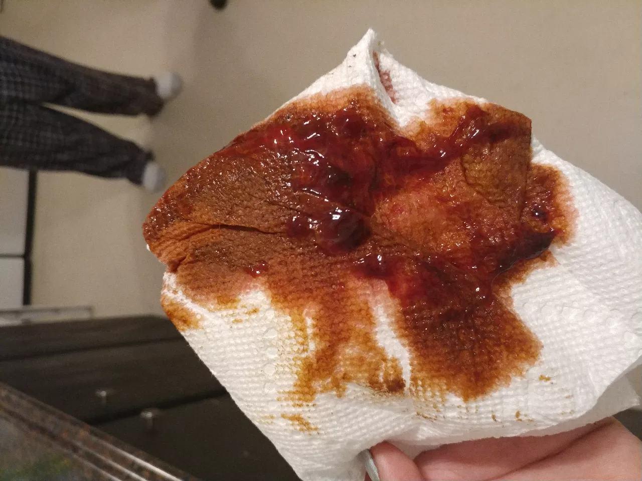 Question details sensitive content