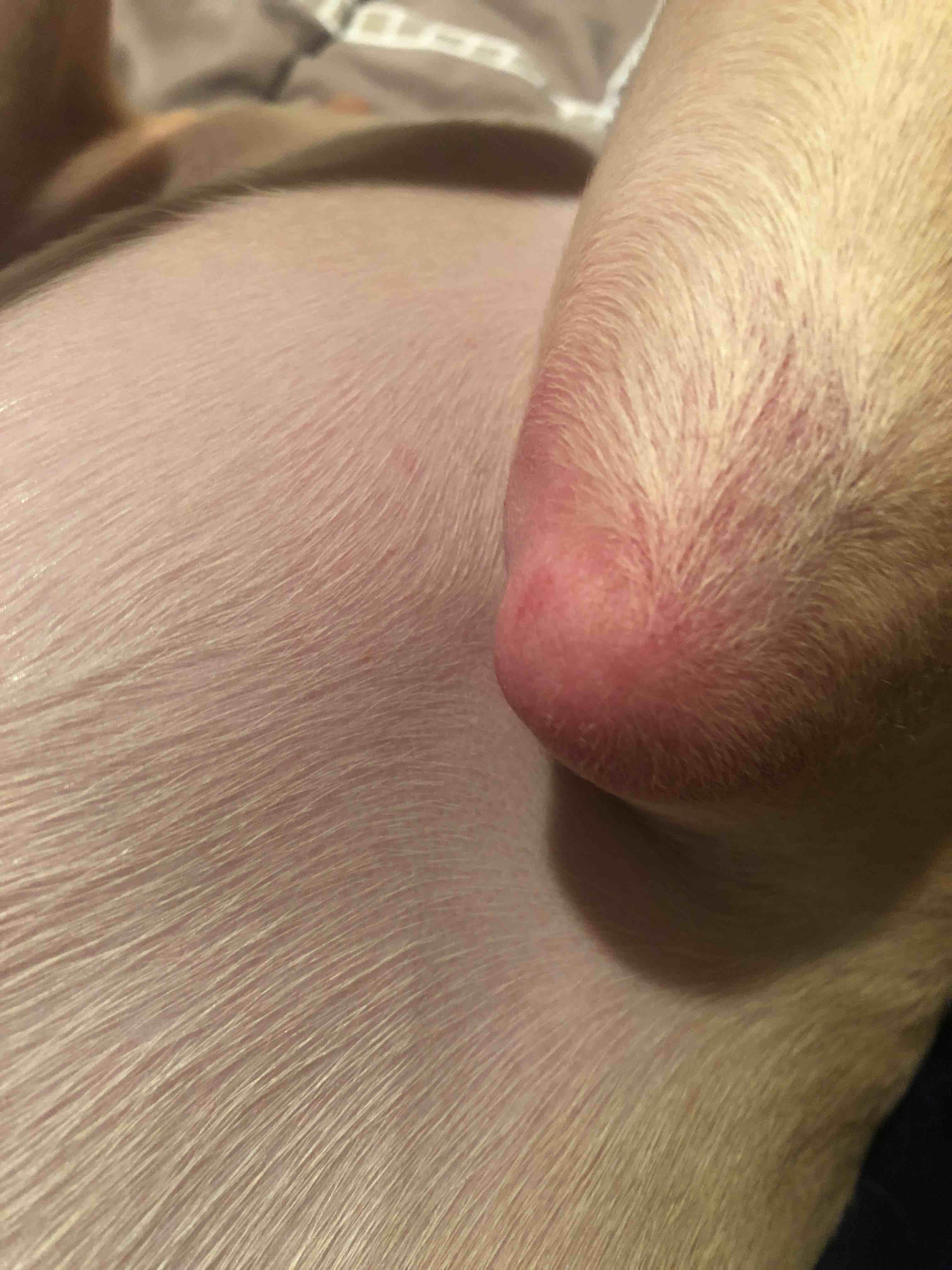 Question details sensitive content