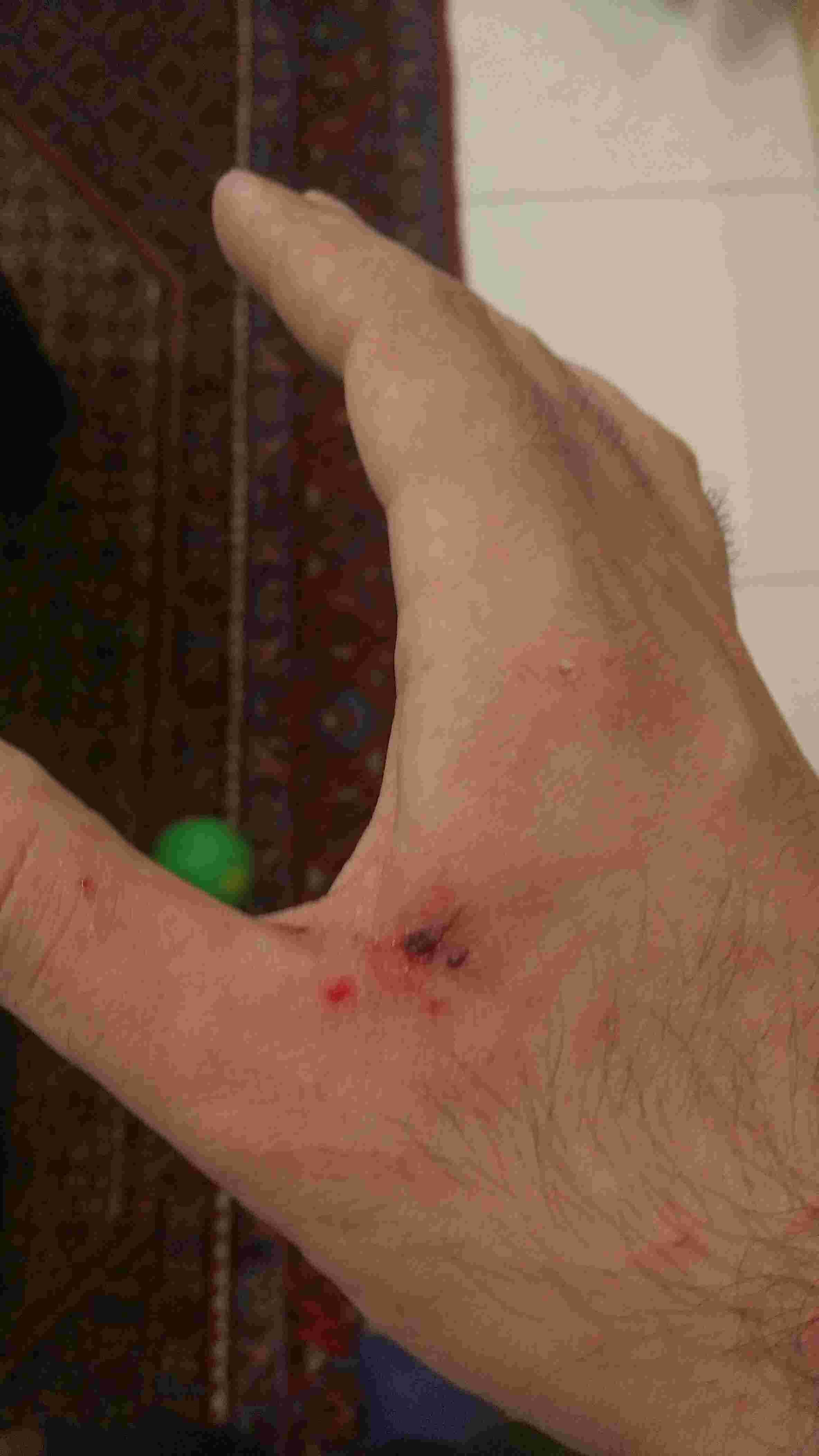 Question details sensitive content