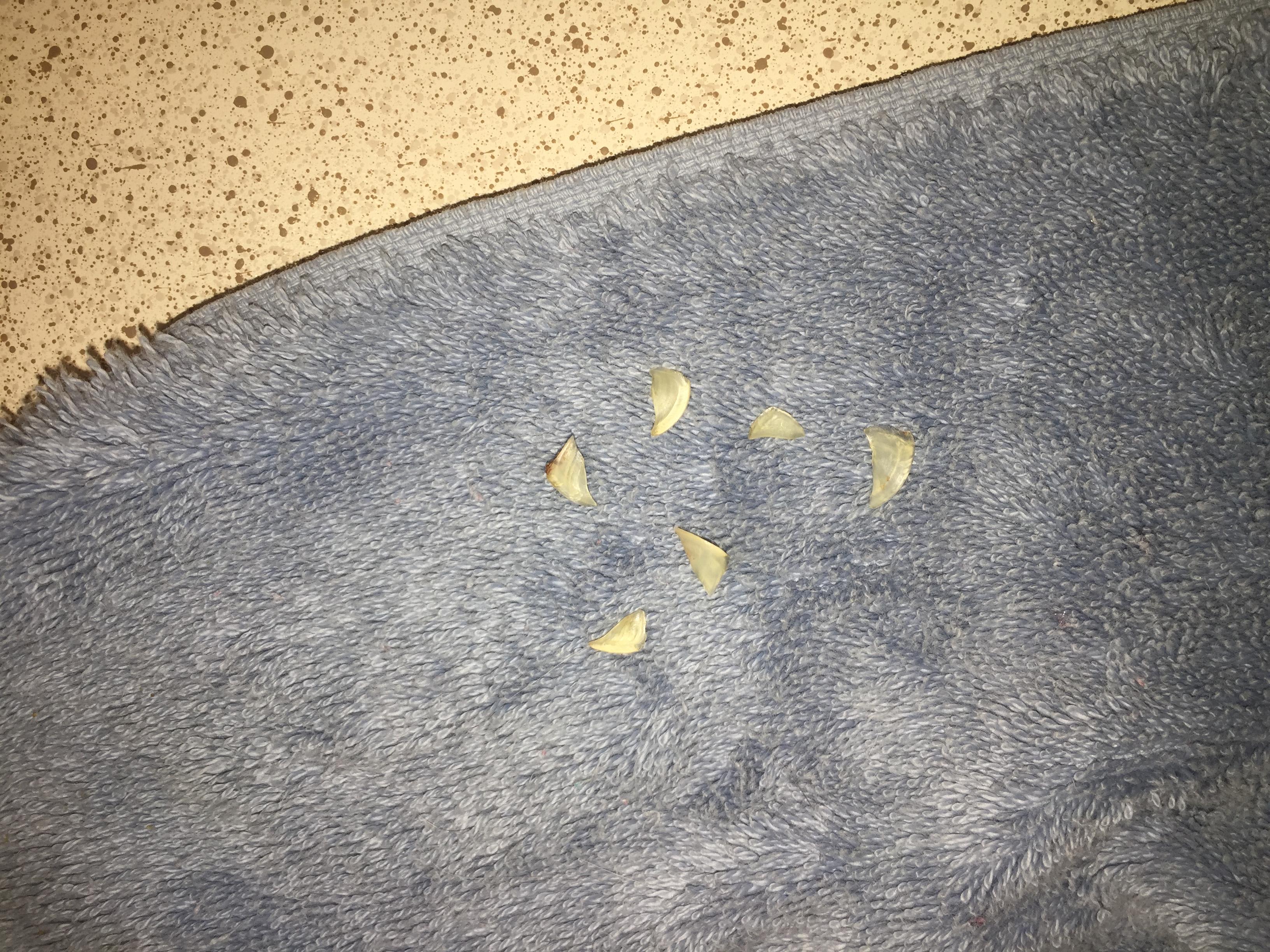 Question details sensitive content