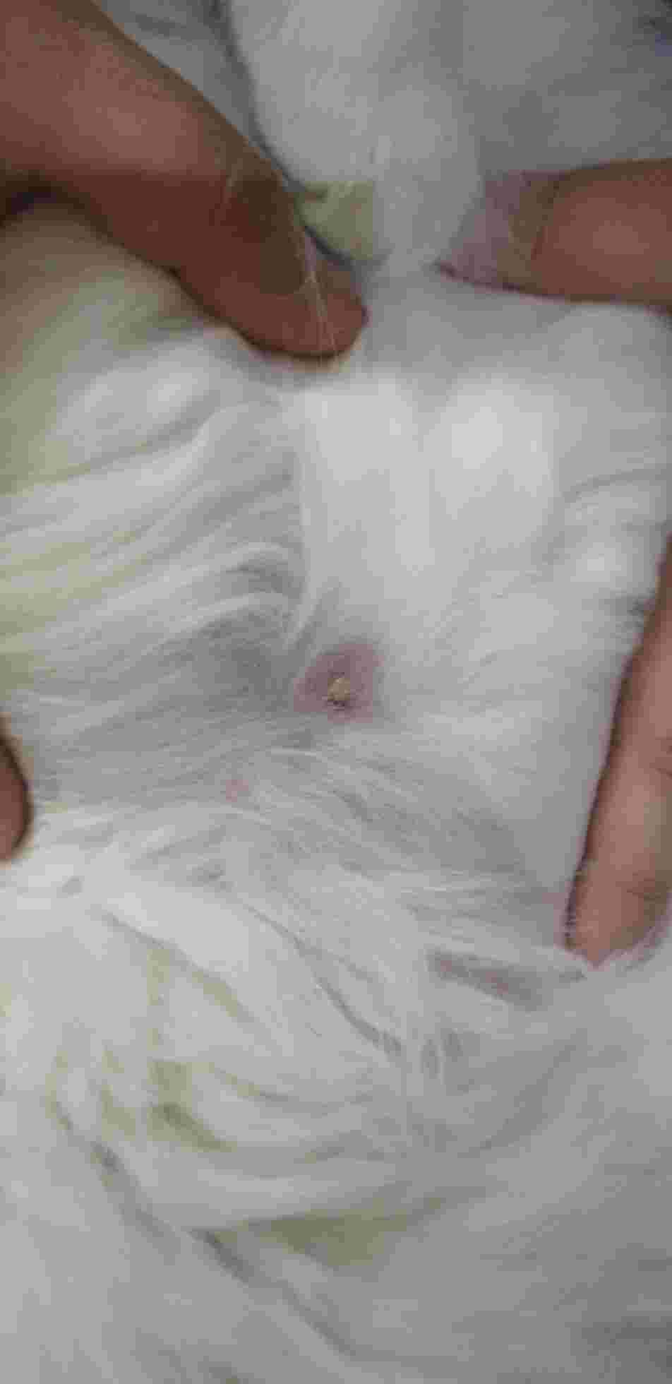 Question details sensitive content