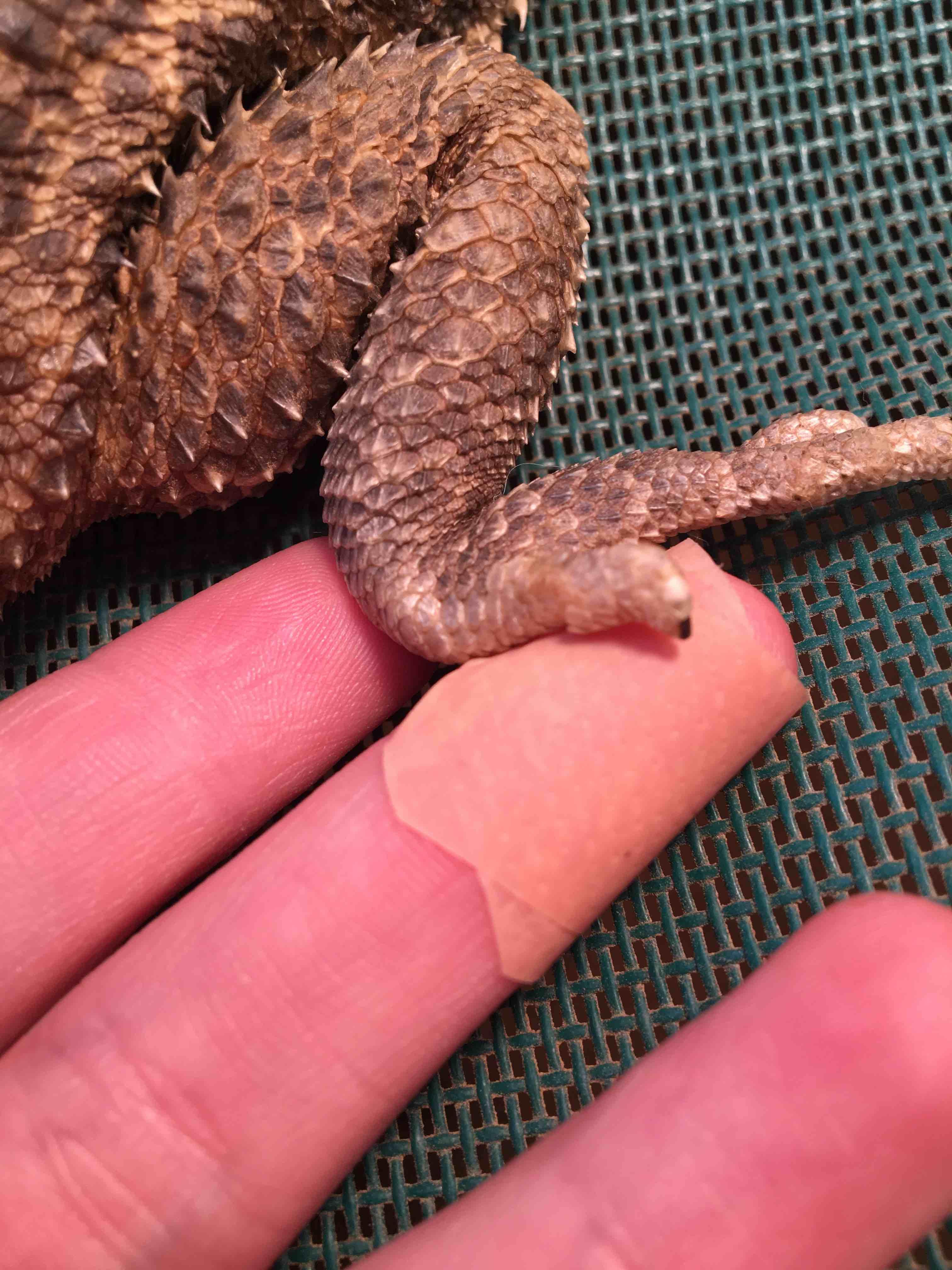 Question details sensitive content