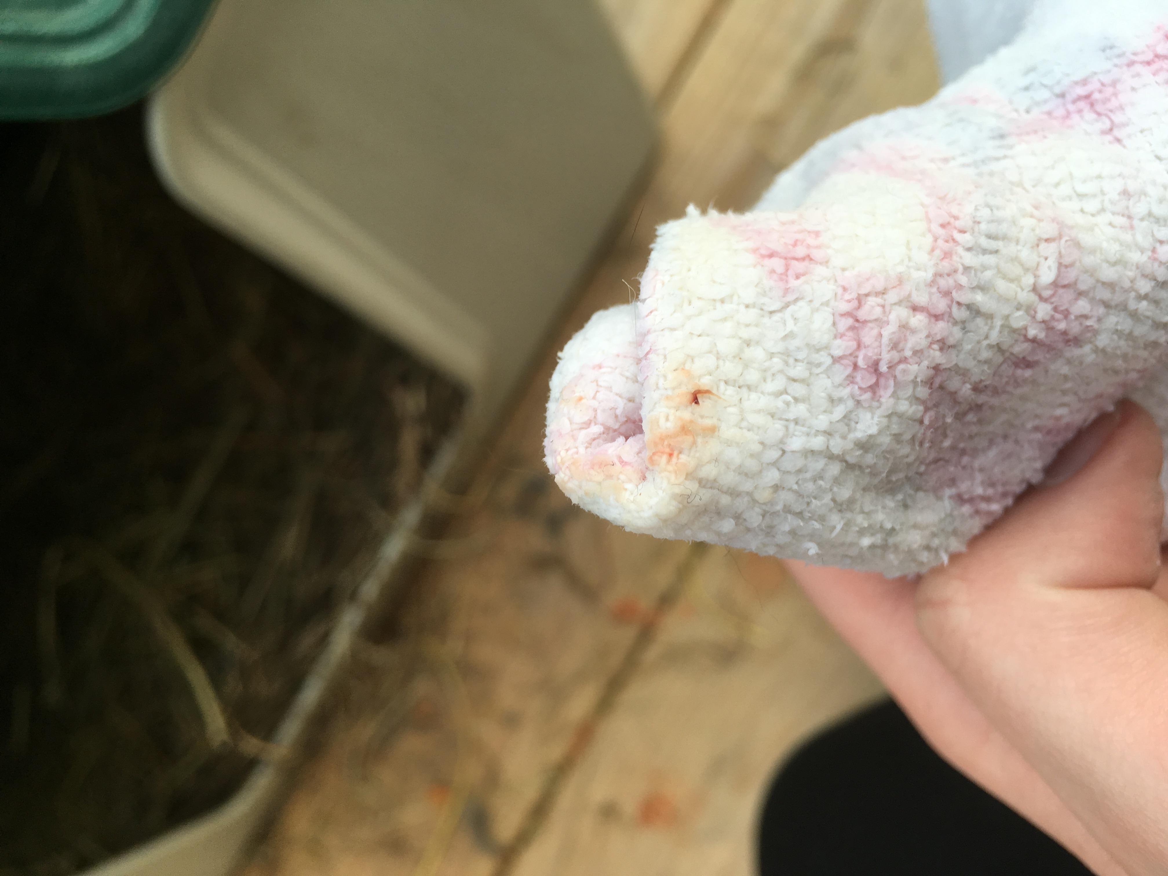 Question details sensitive content