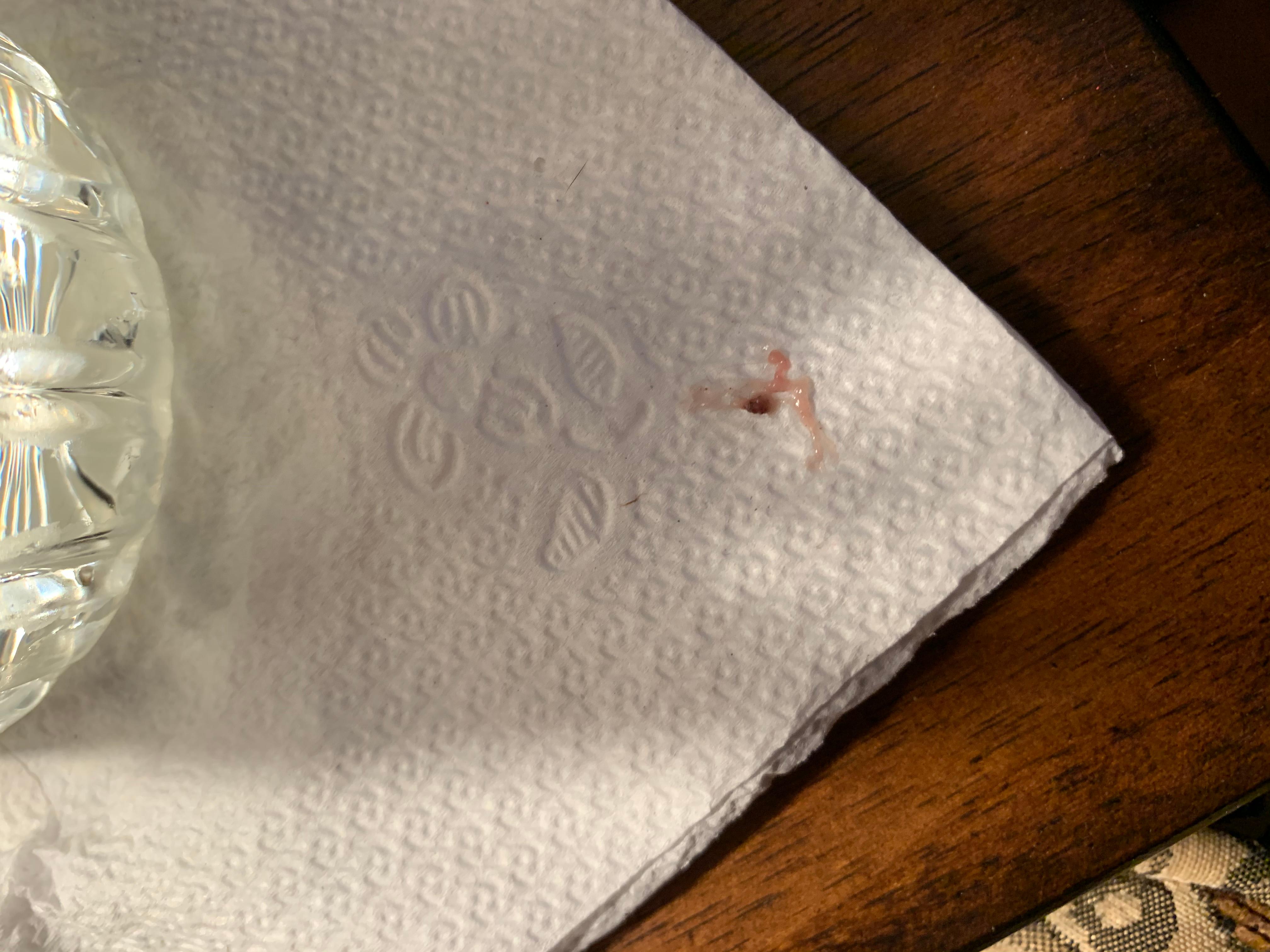 Question details sensitive content