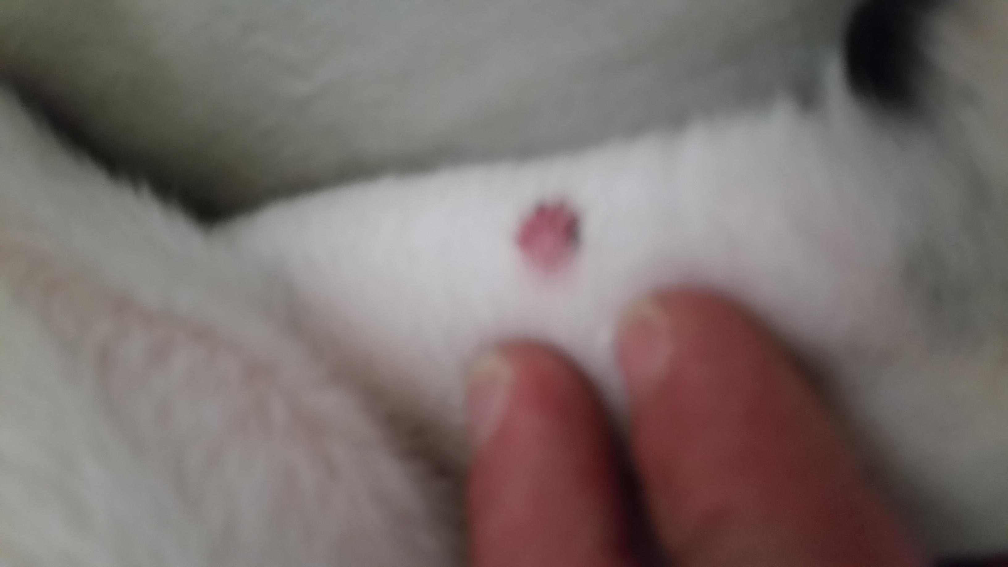 Question details sensitive content