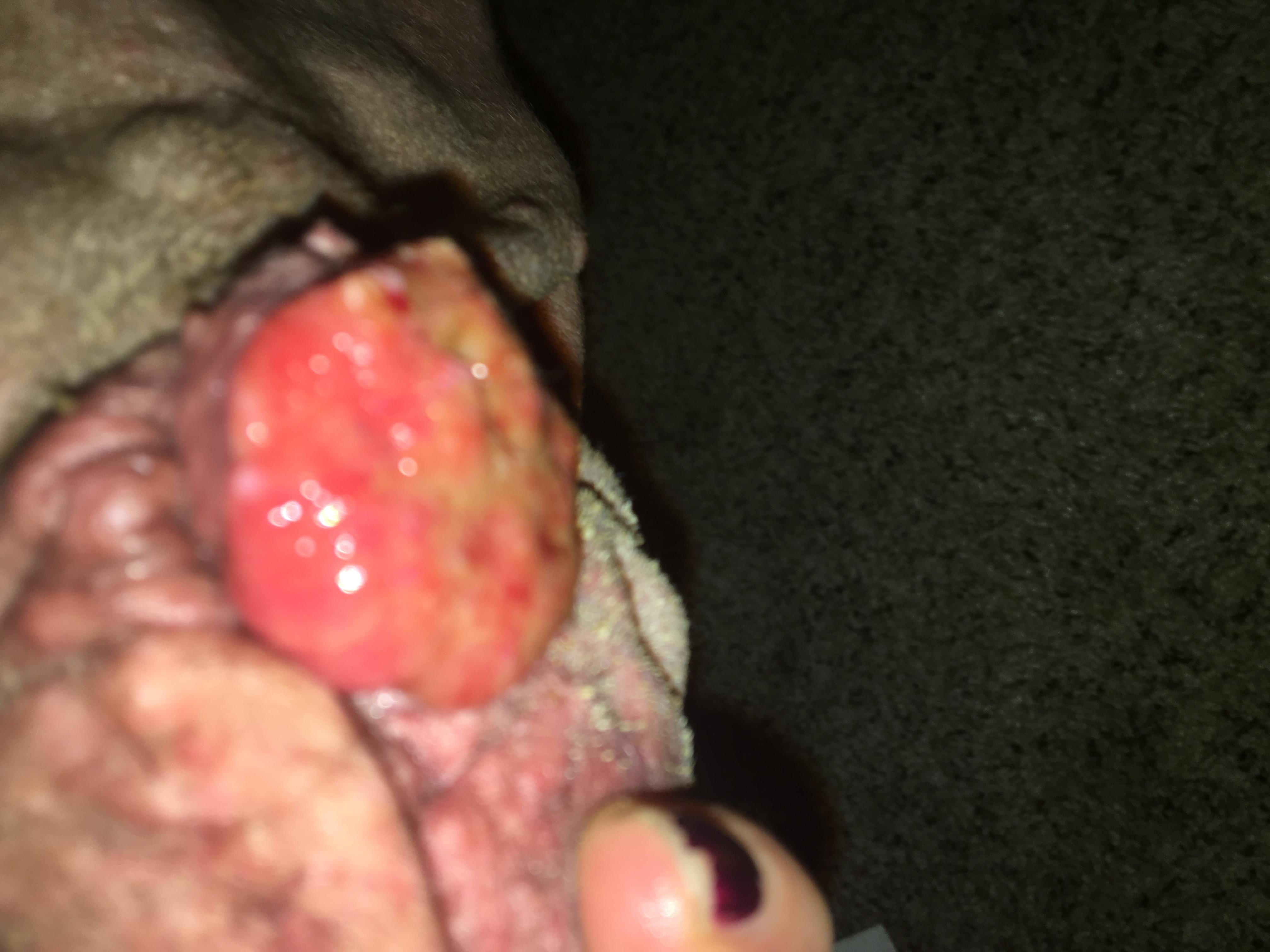 Question details sensitive content