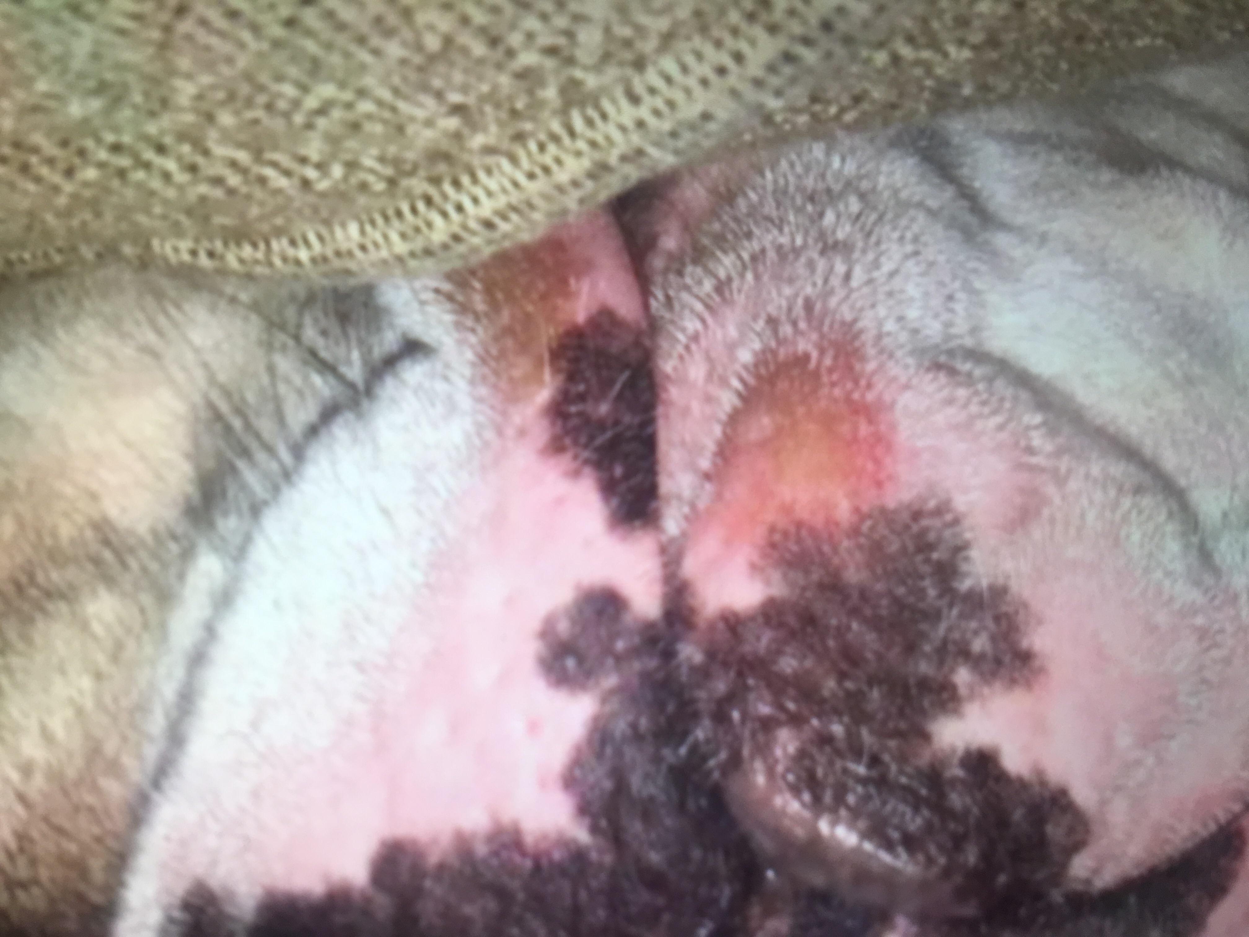 Question details sensitive content