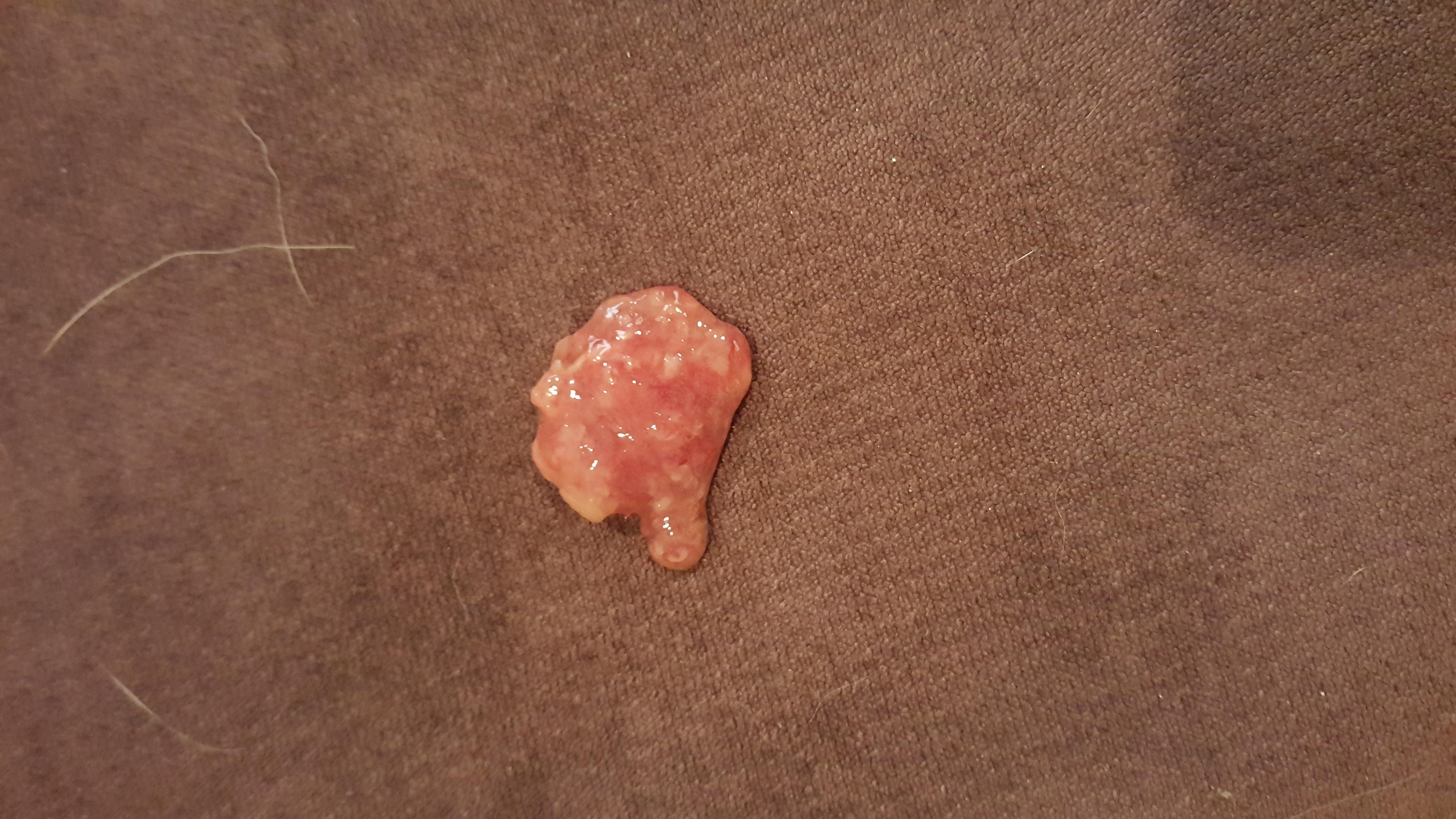 Question details sensitive content