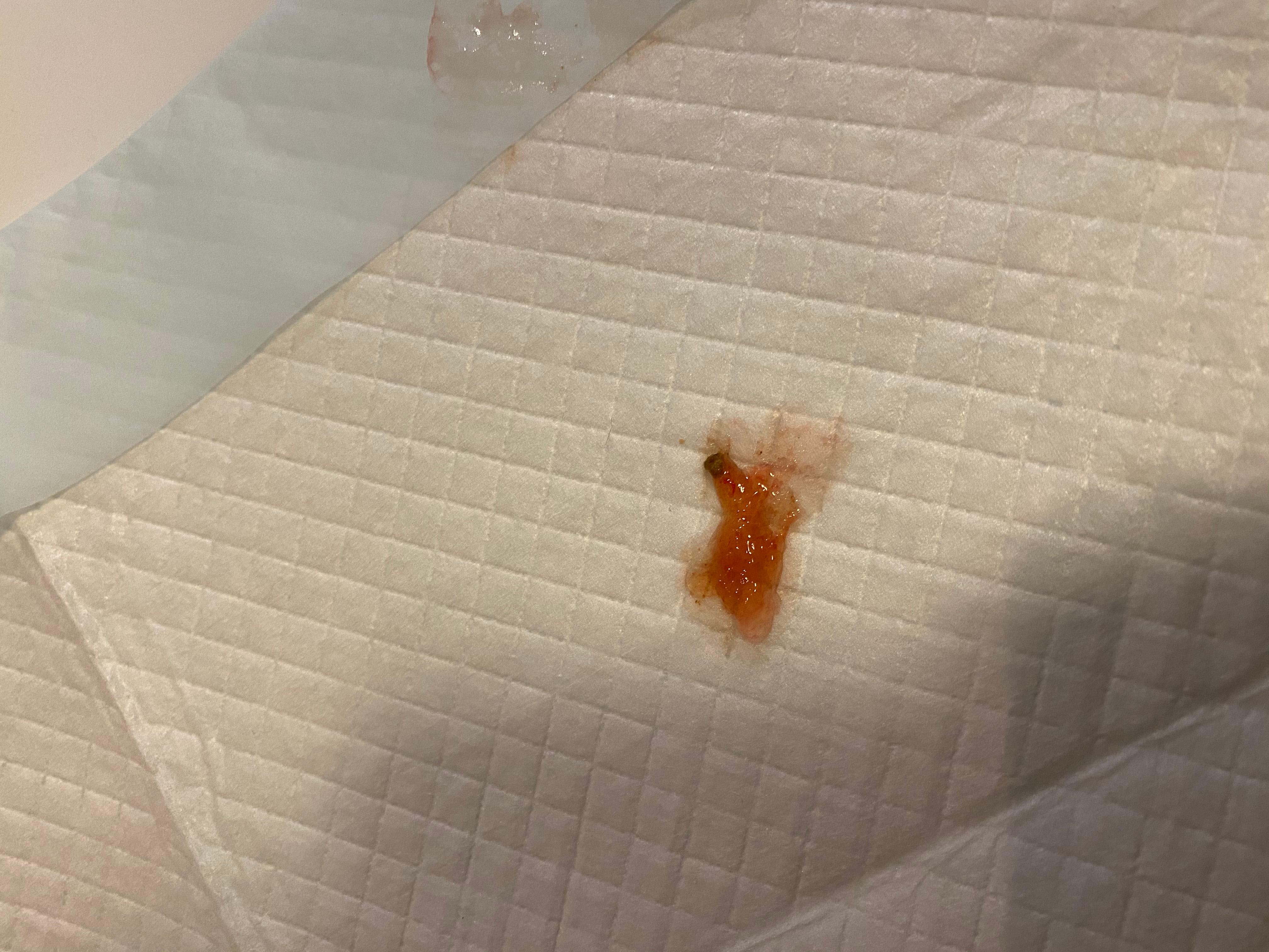 Question details sensitive content