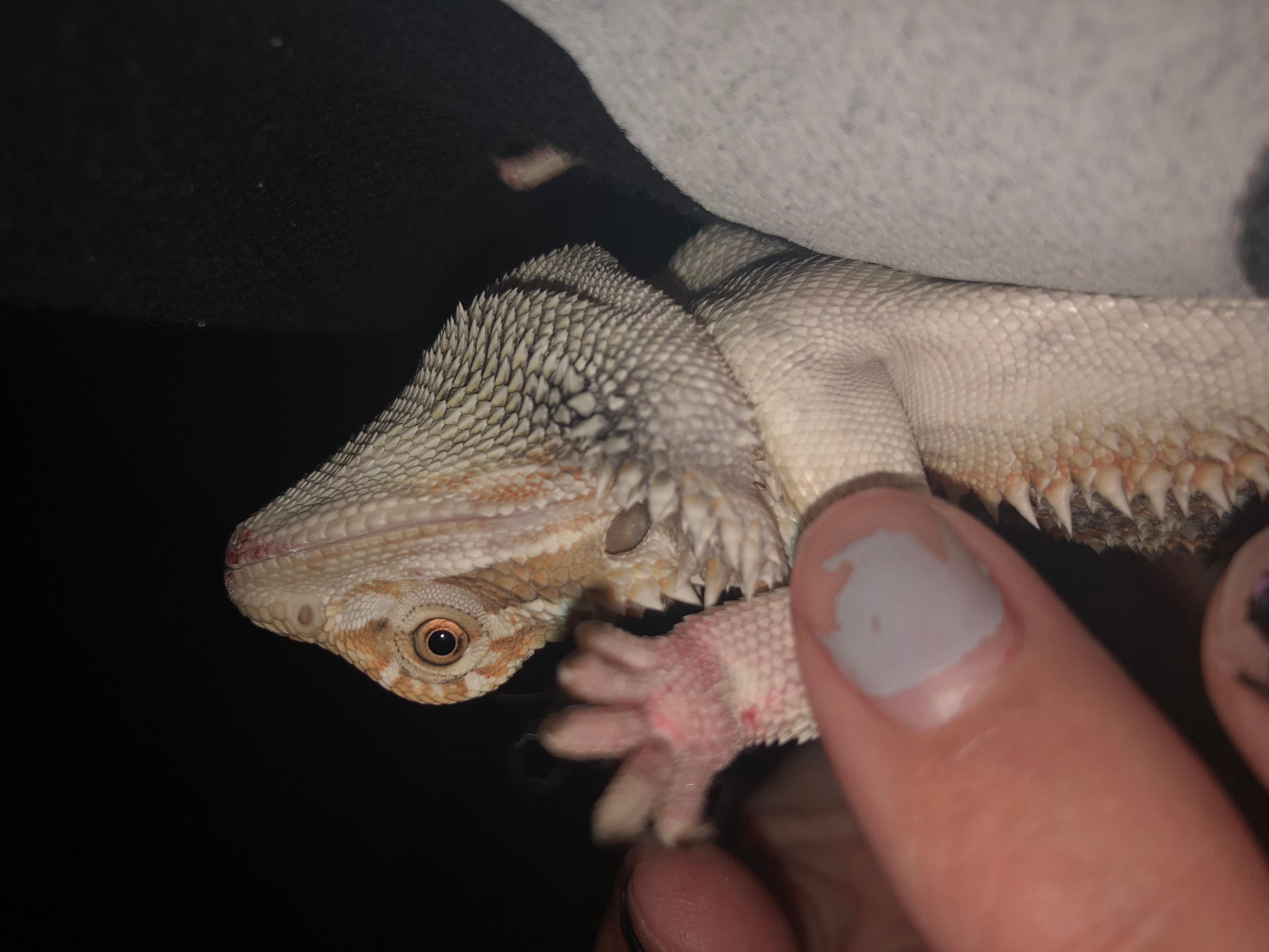 Question details sensitive content