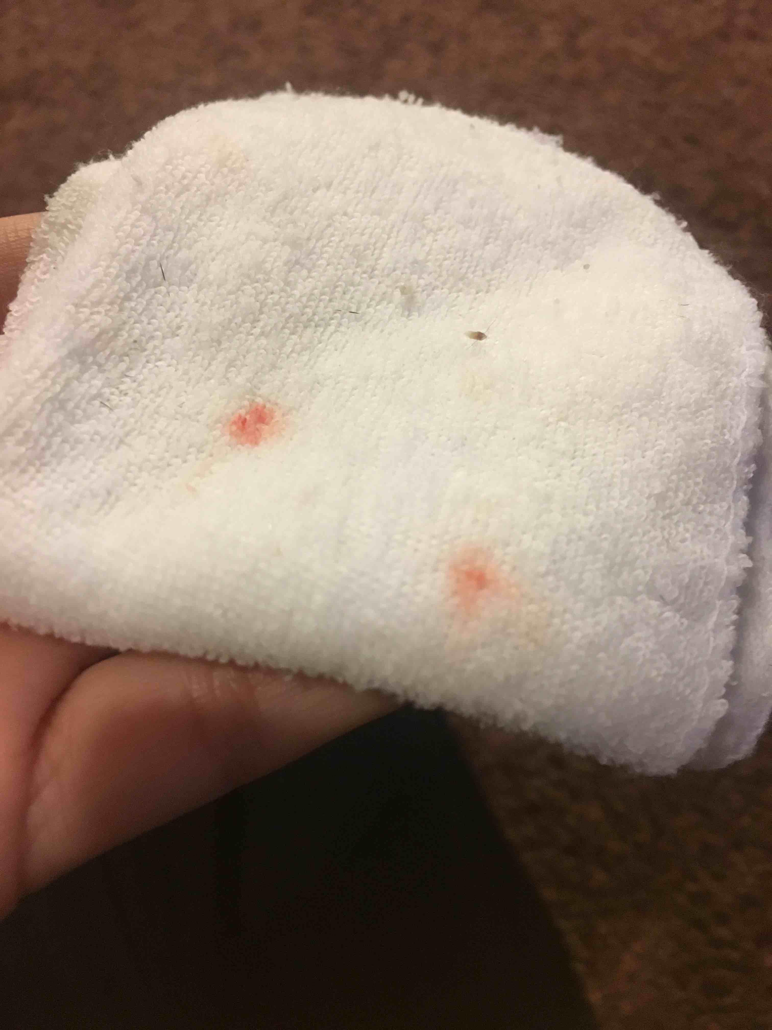 Question details sensitive content