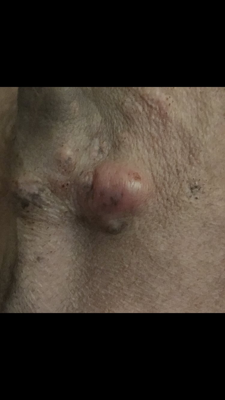 Question details sensitive content