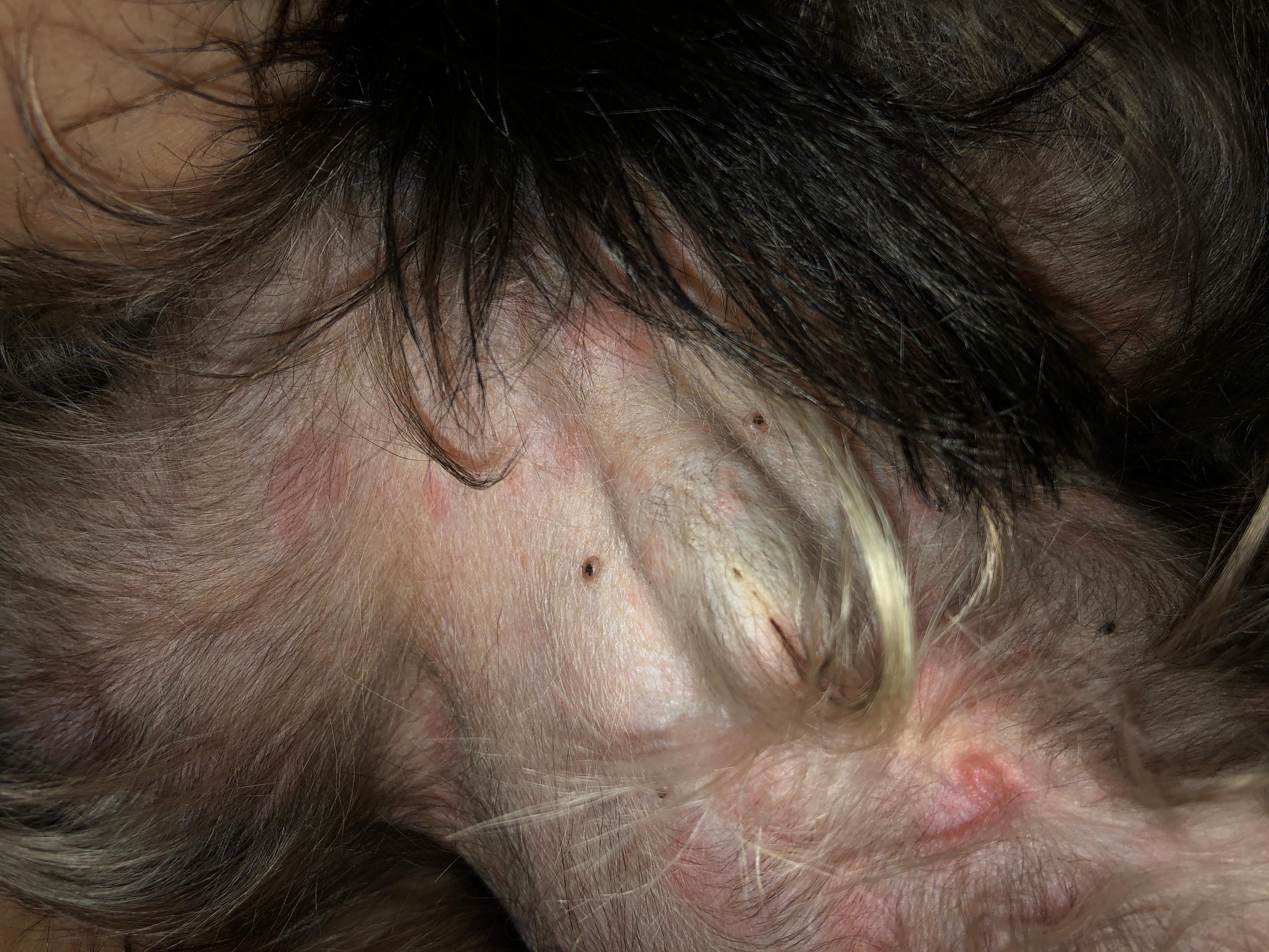 Question details sensitive content