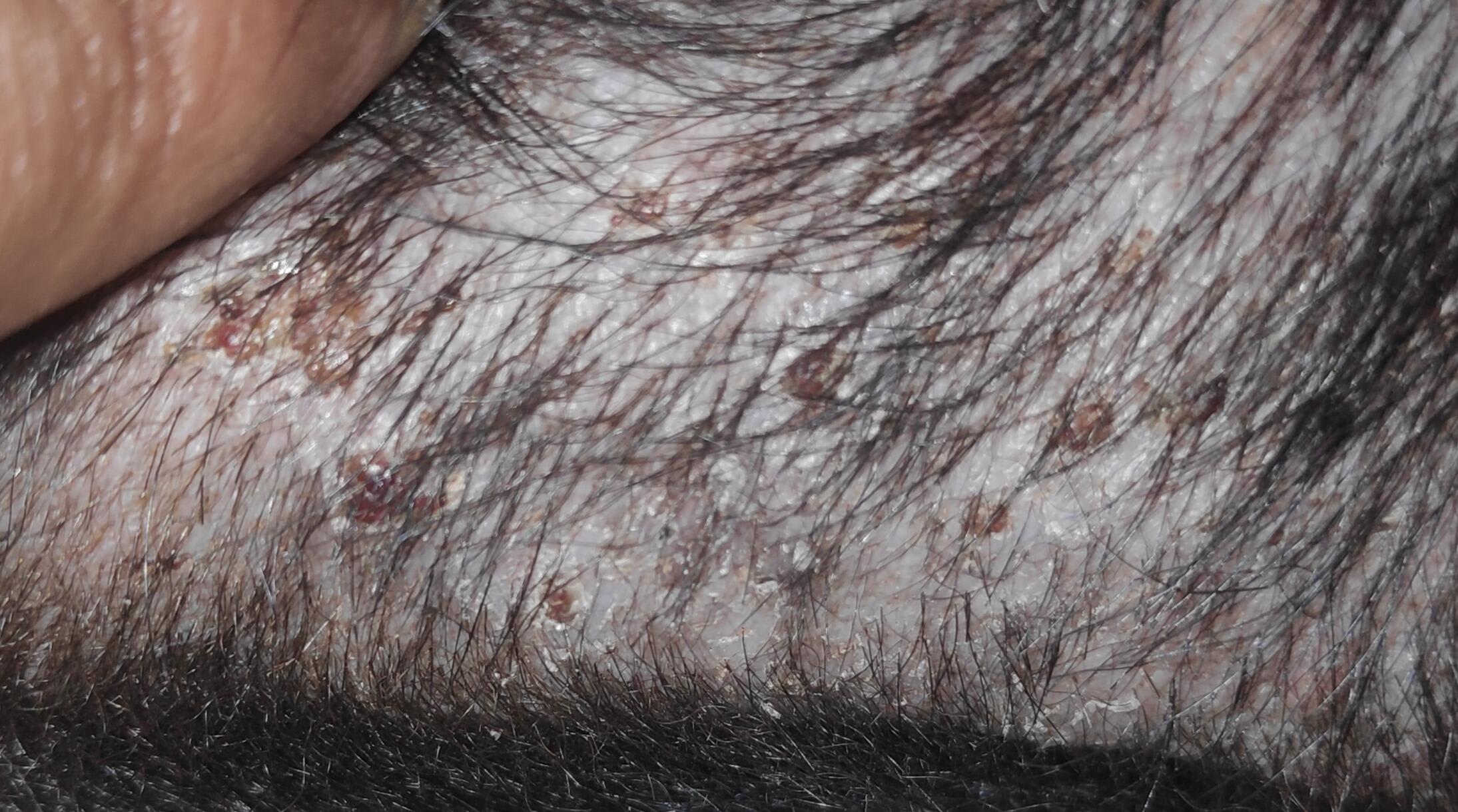 Question details sensitive content