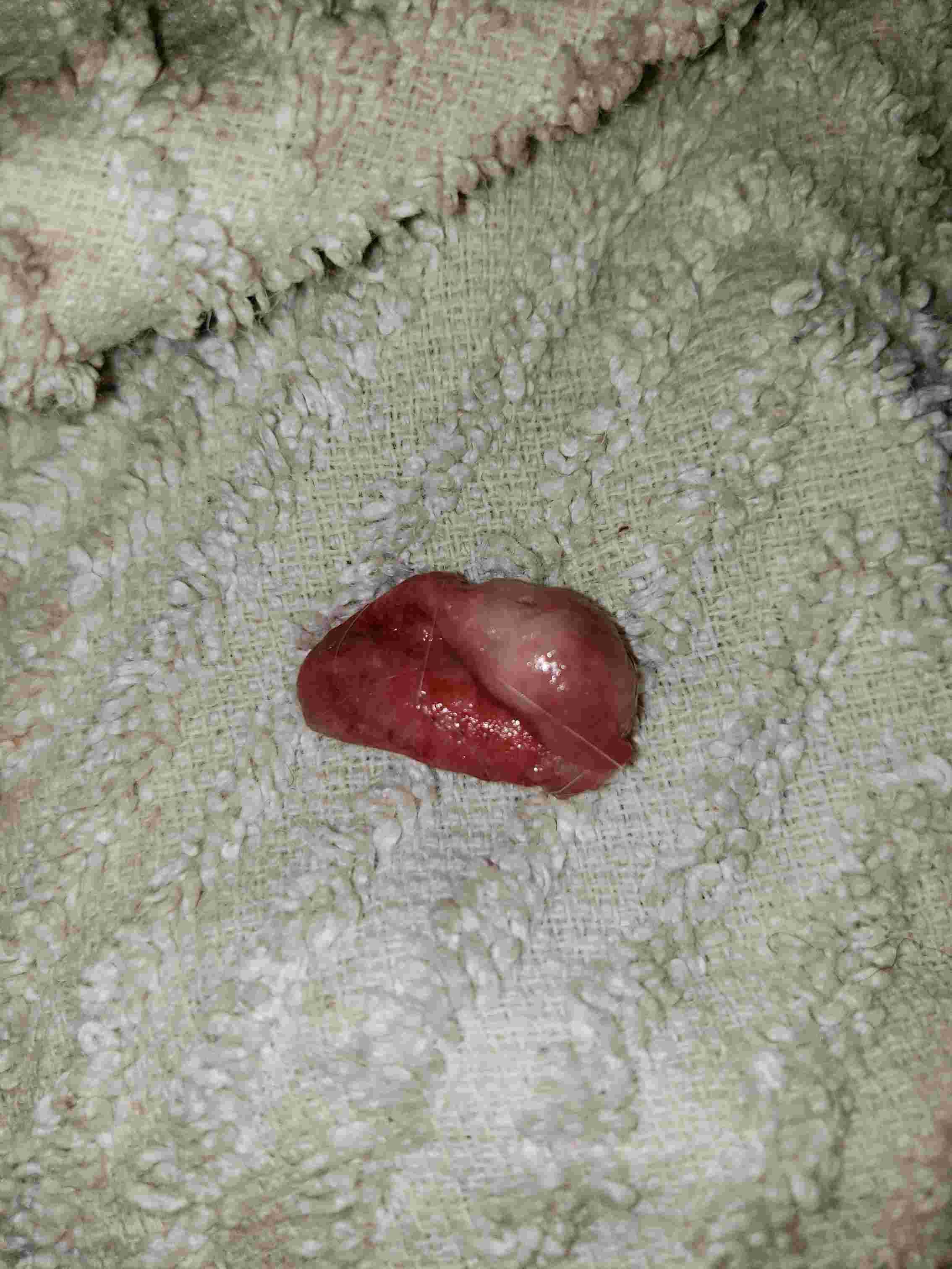 Question details sensitive content