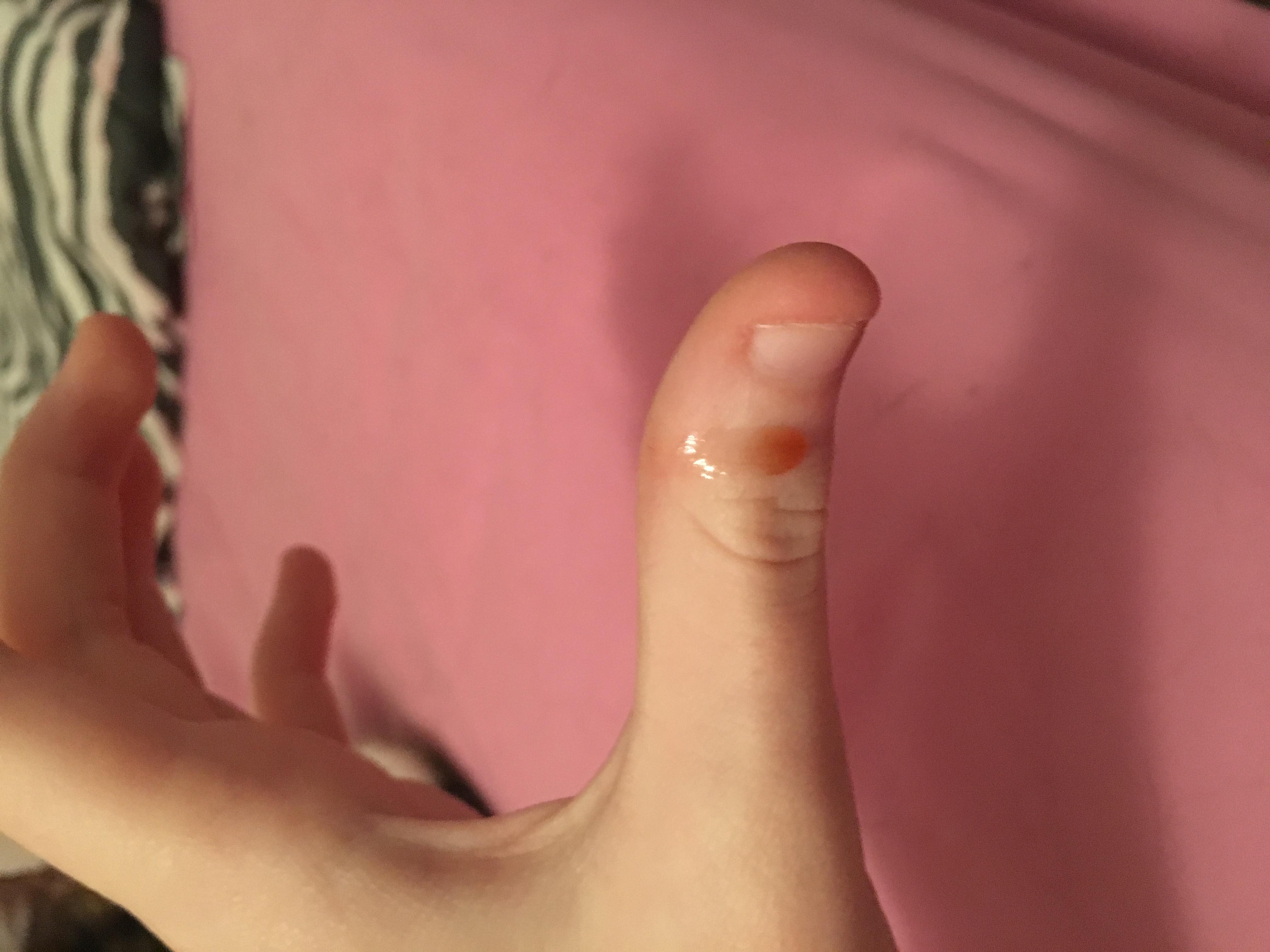 Question details sensitive content