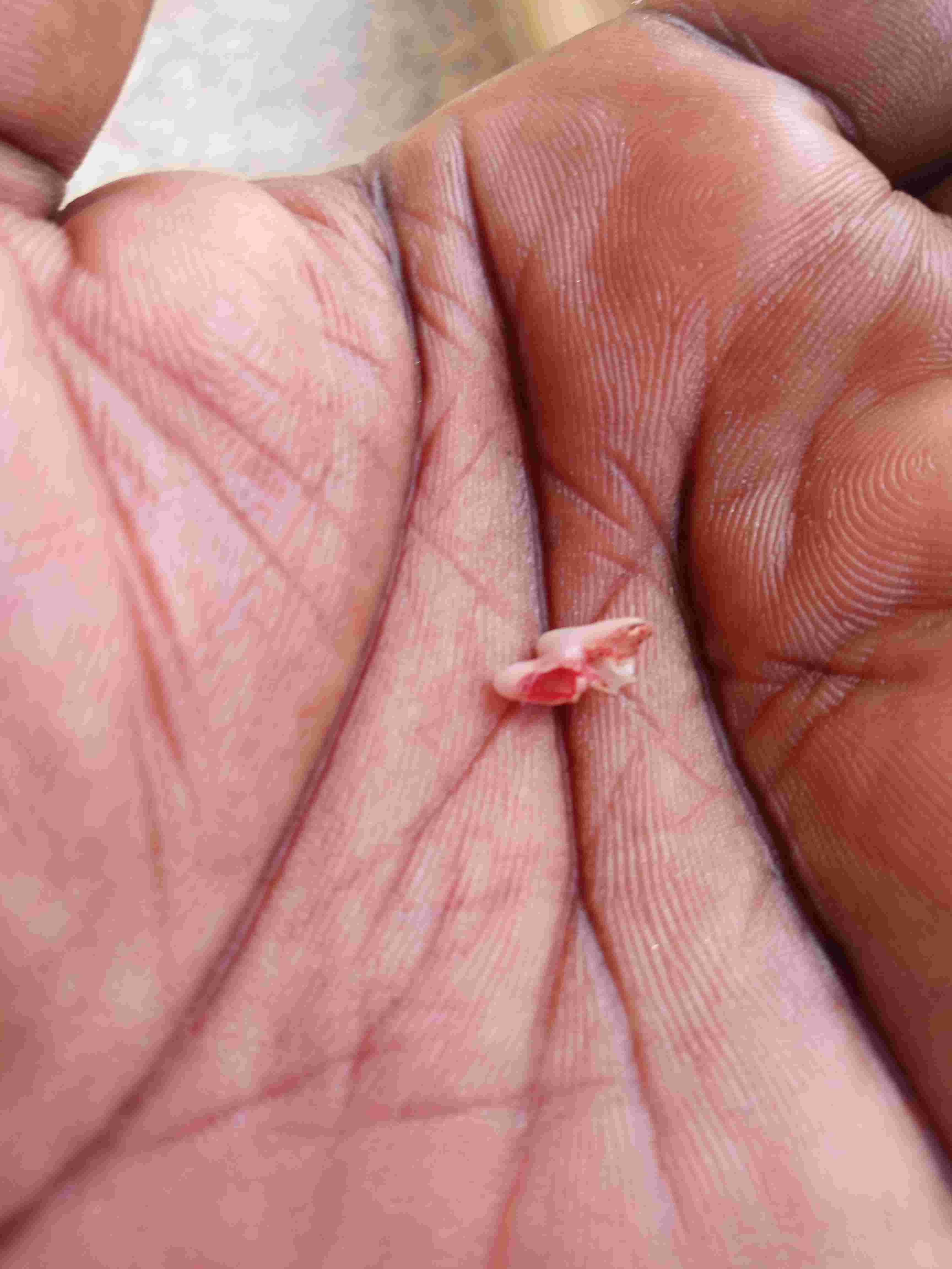 Question details sensitive content