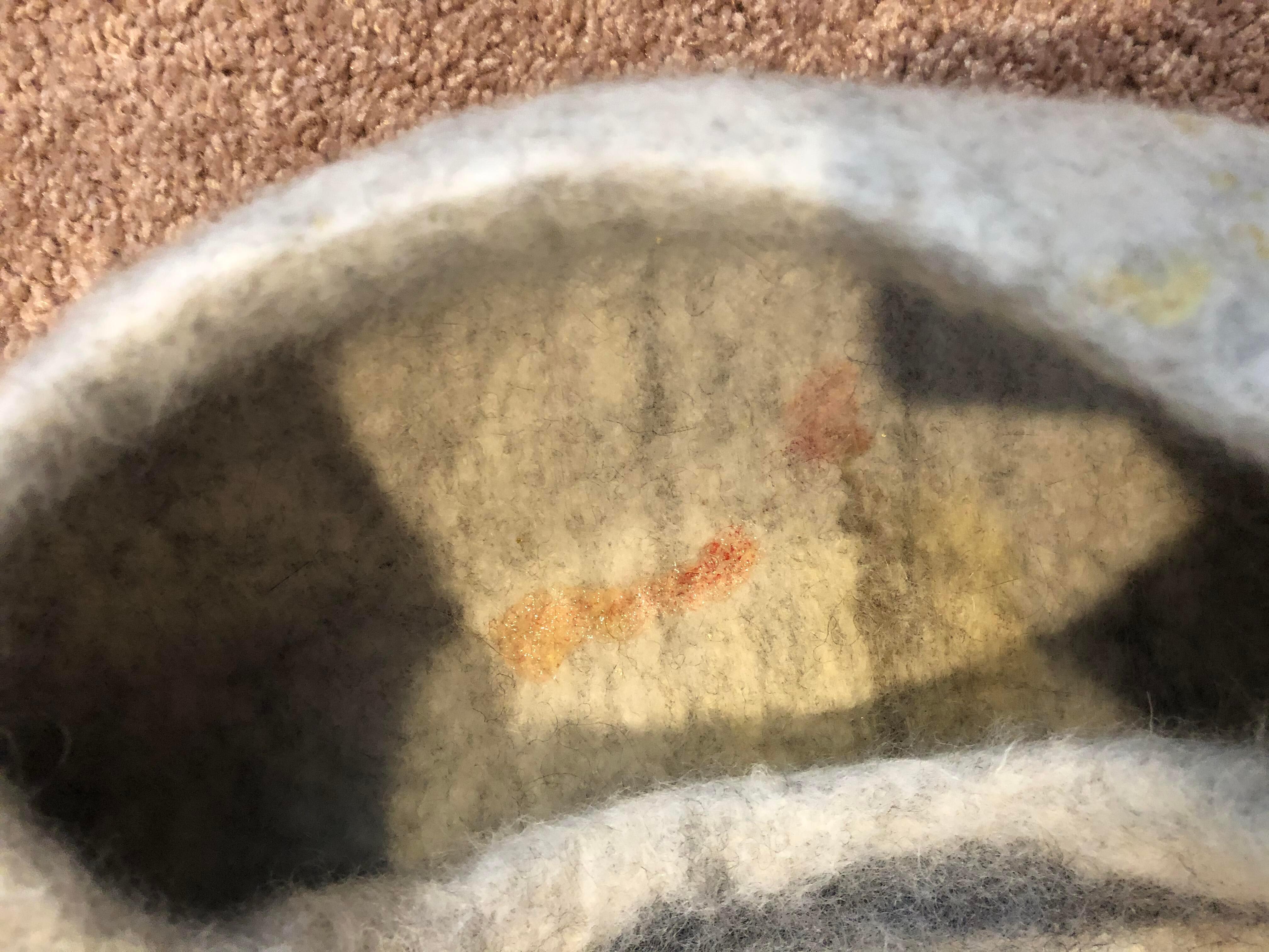 Question details sensitive content