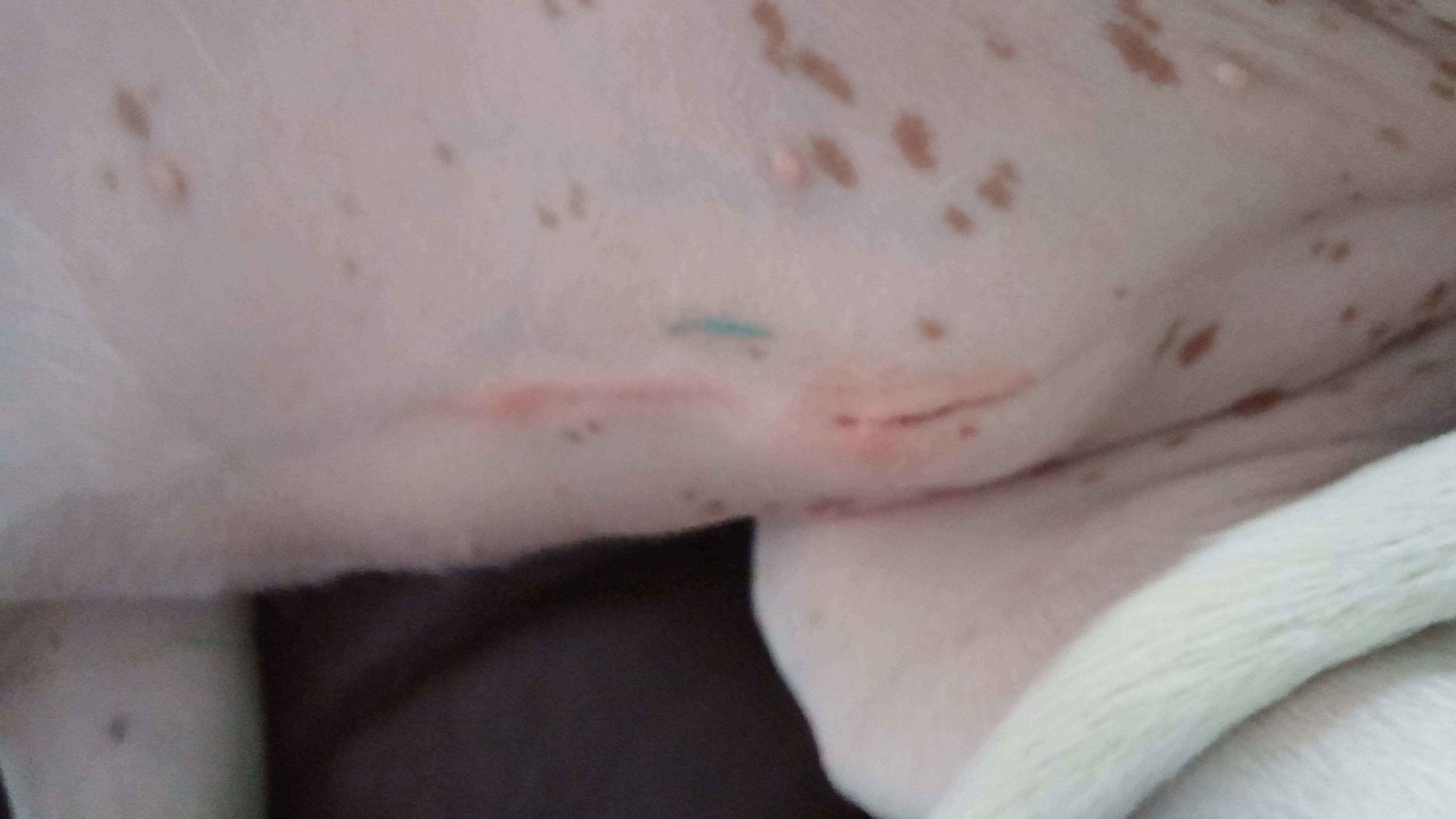 Question details sensitive content