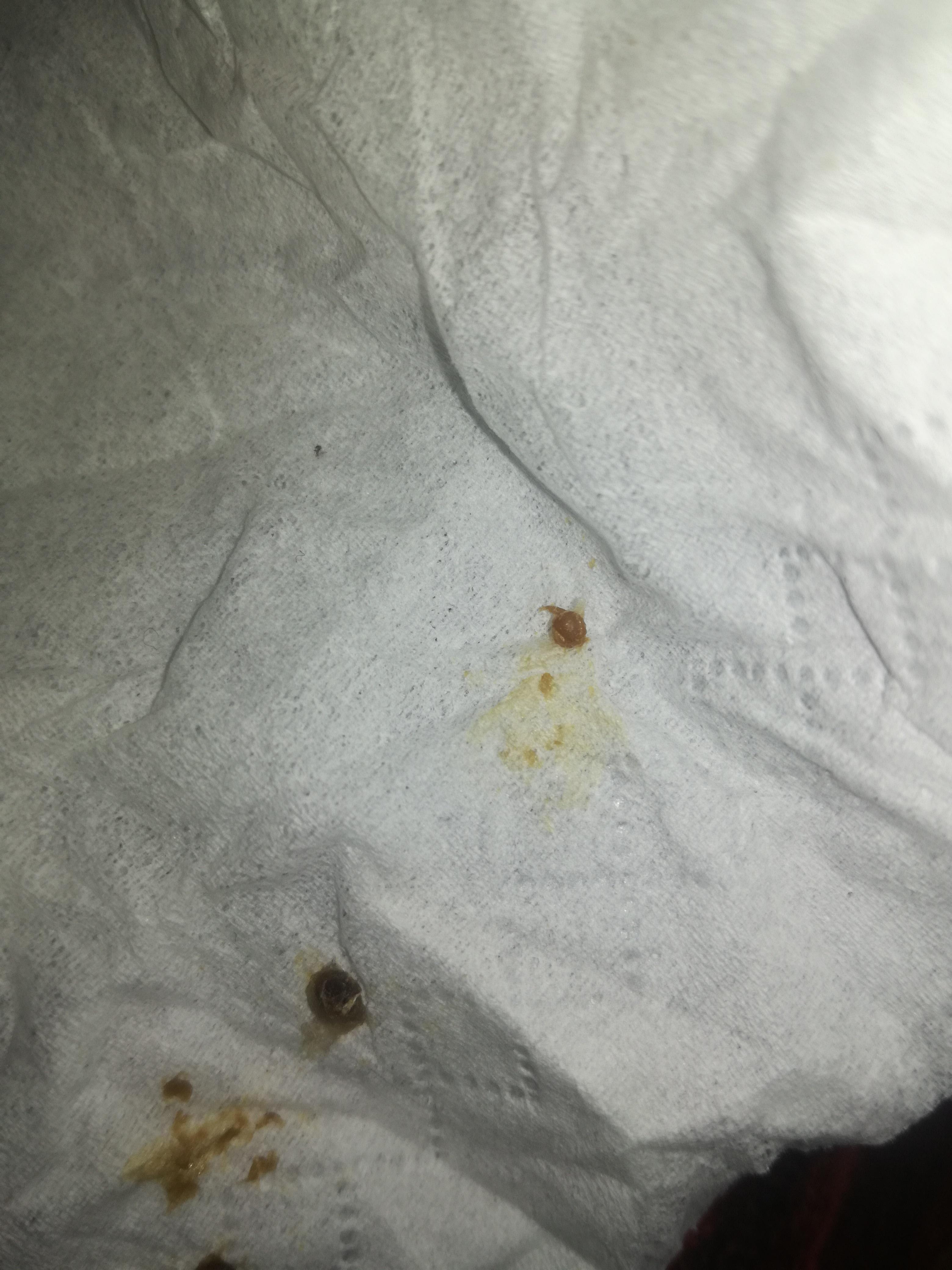 Question details sensitive content