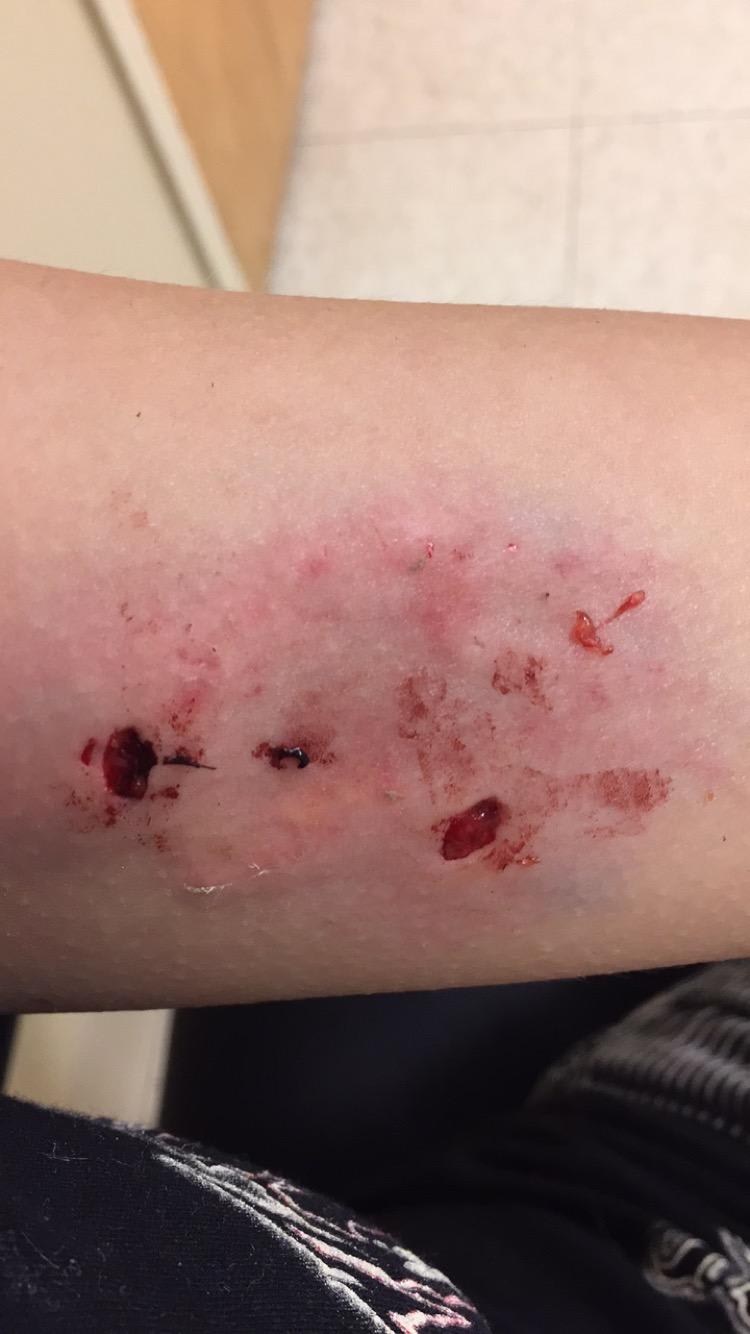 Question details sensitive content