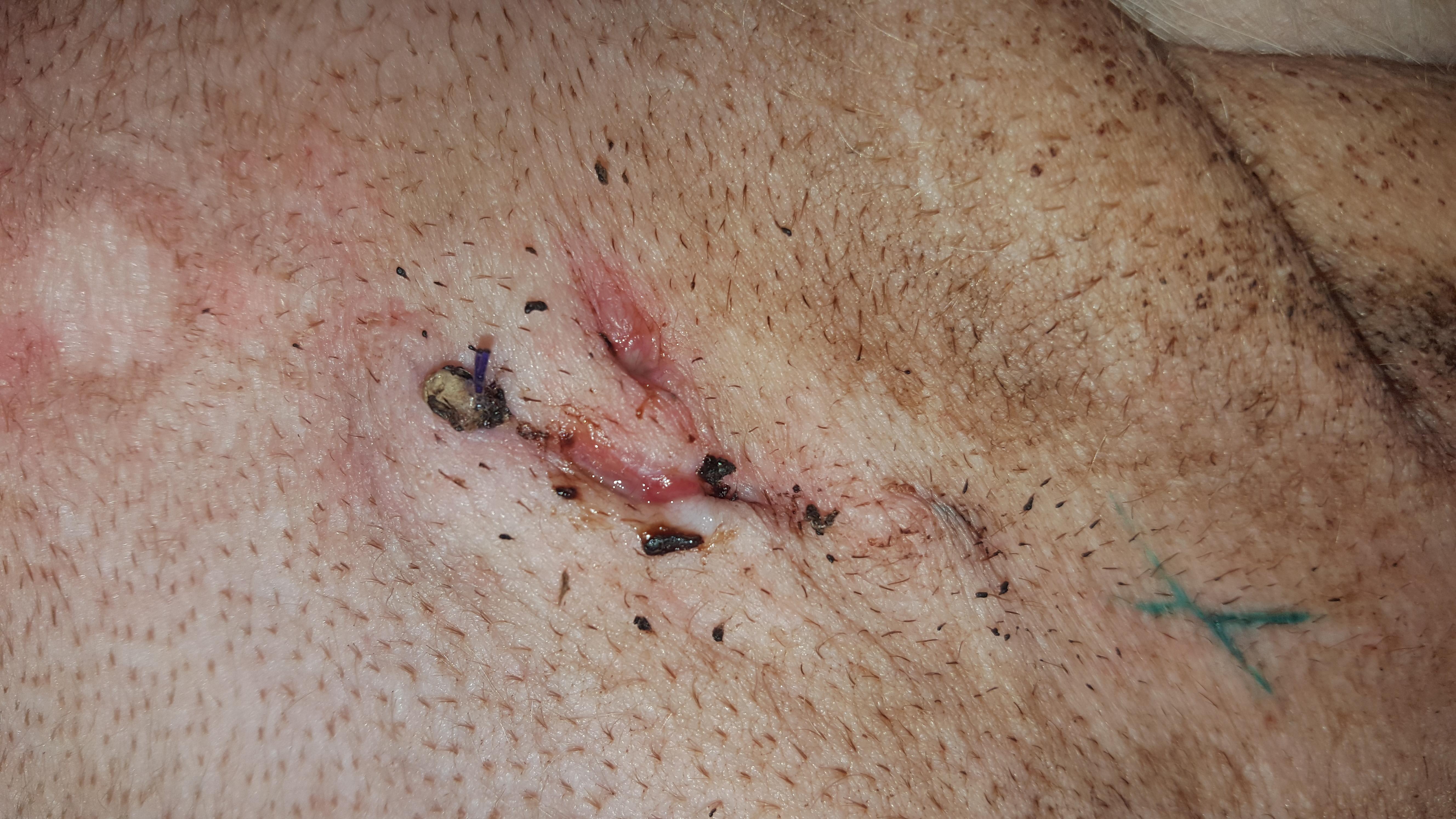 Question details sensitive content