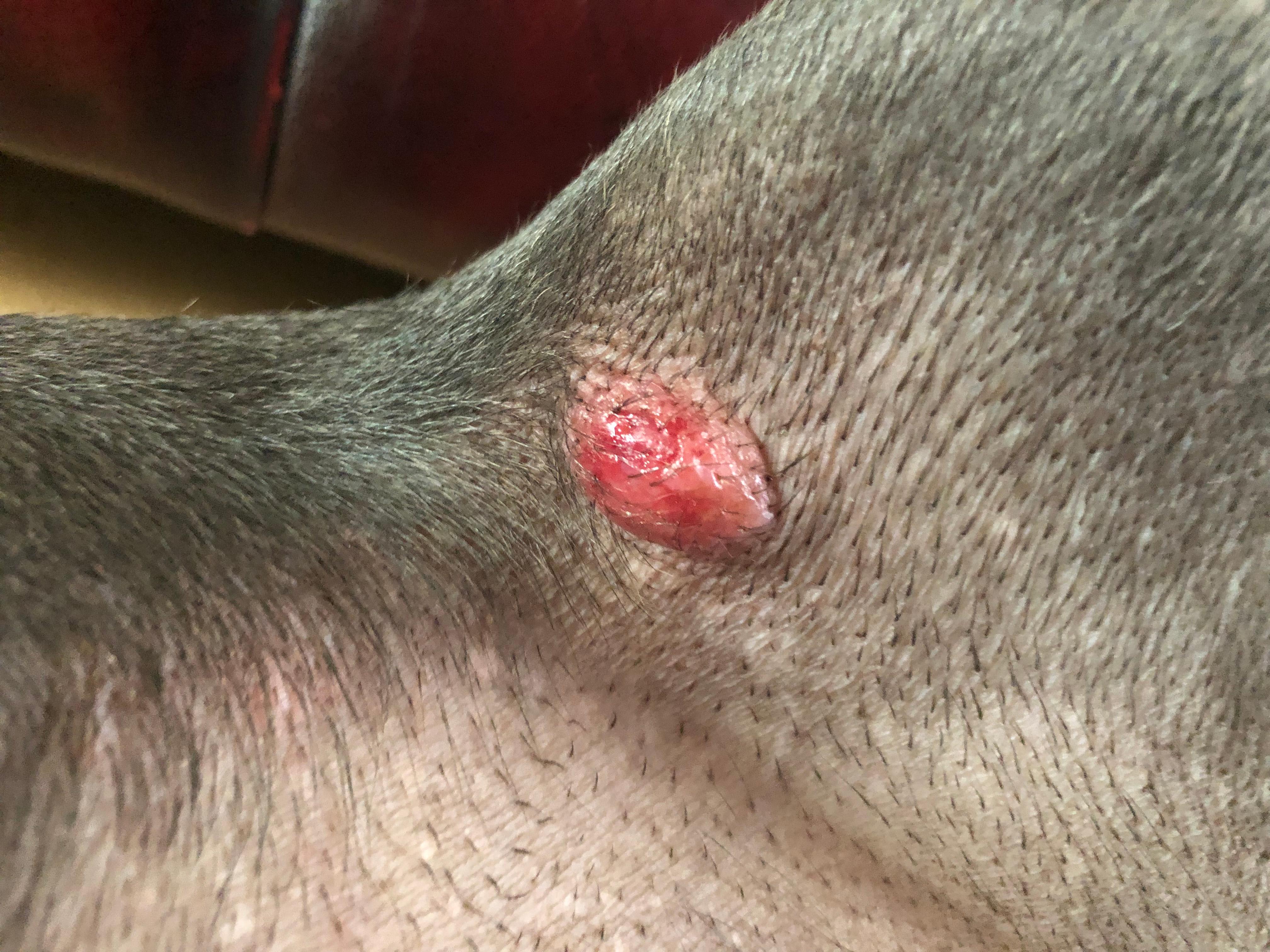 Question details sensitive content