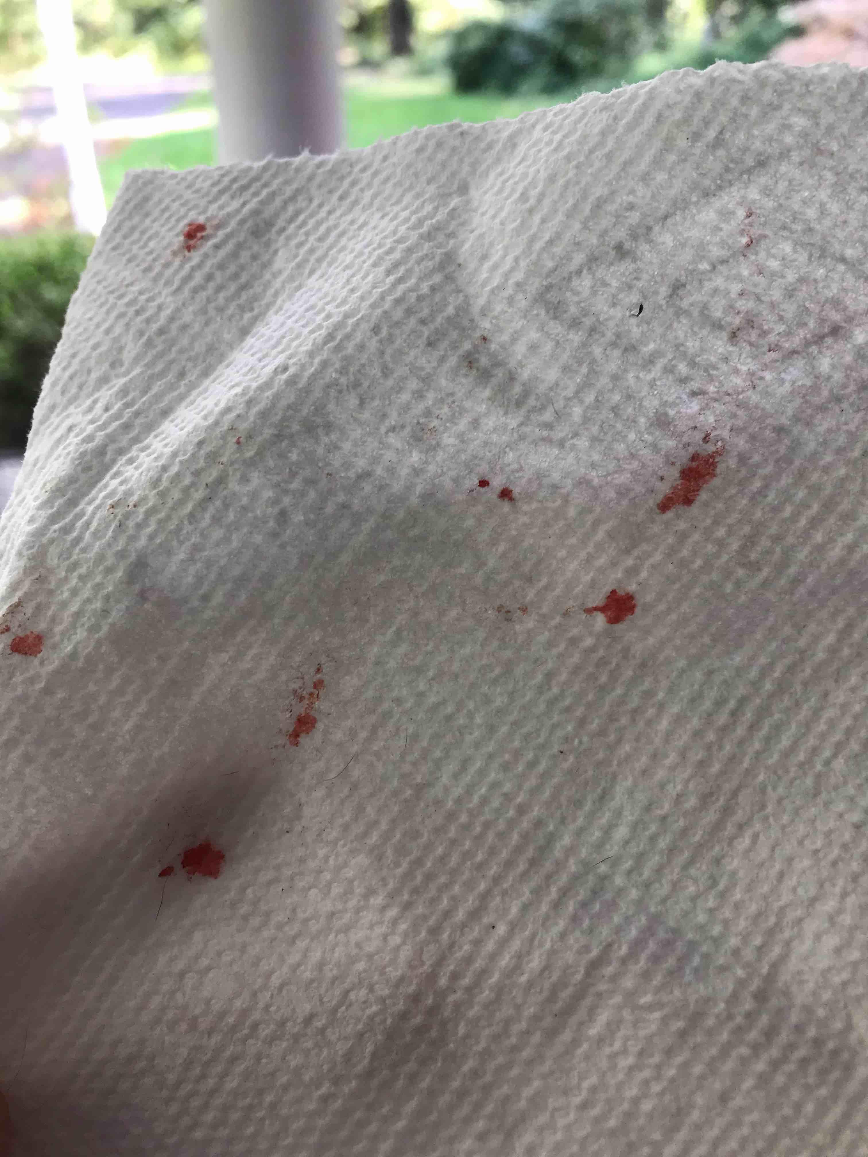 Question details sensitive content