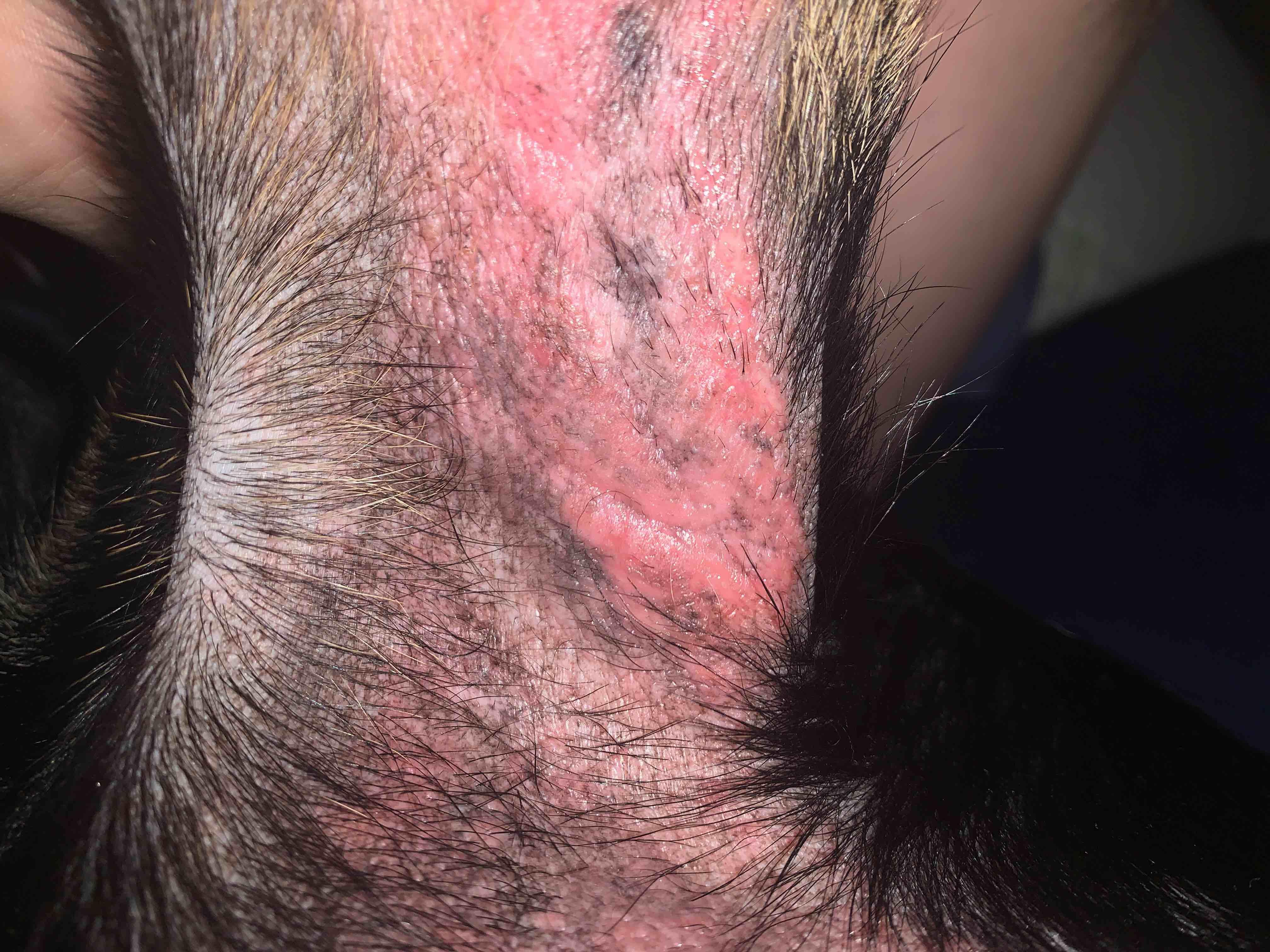 Question details sensitive content