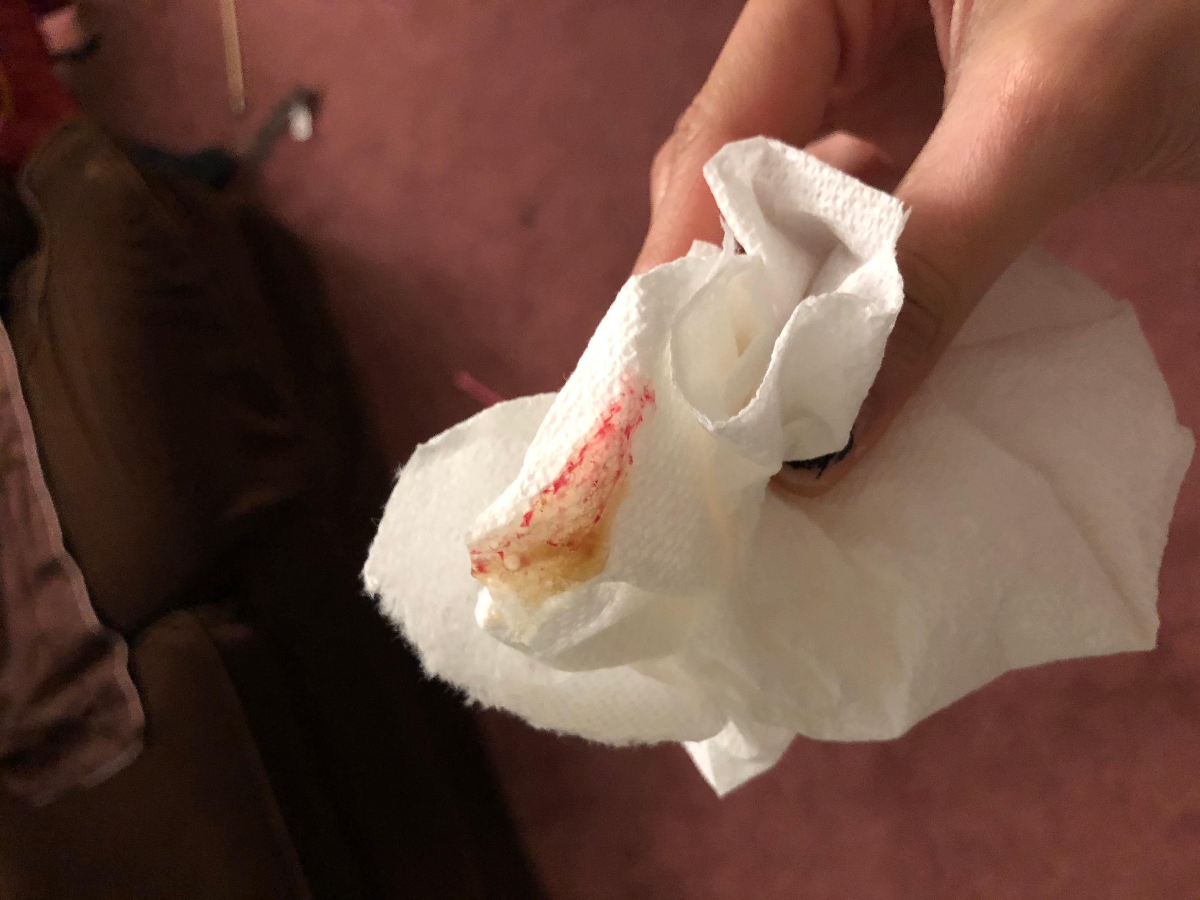 Question details sensitive content