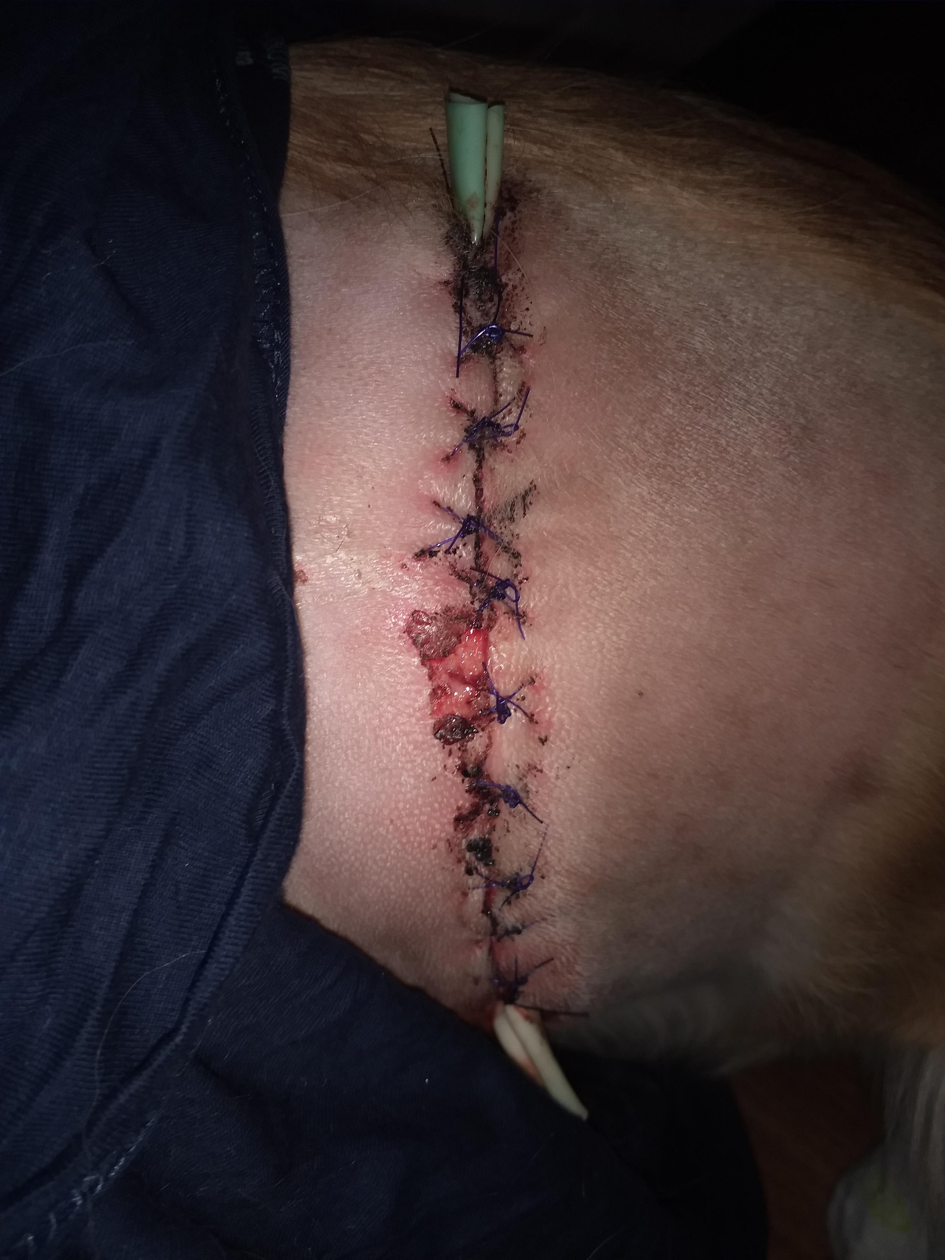 Question details sensitive content