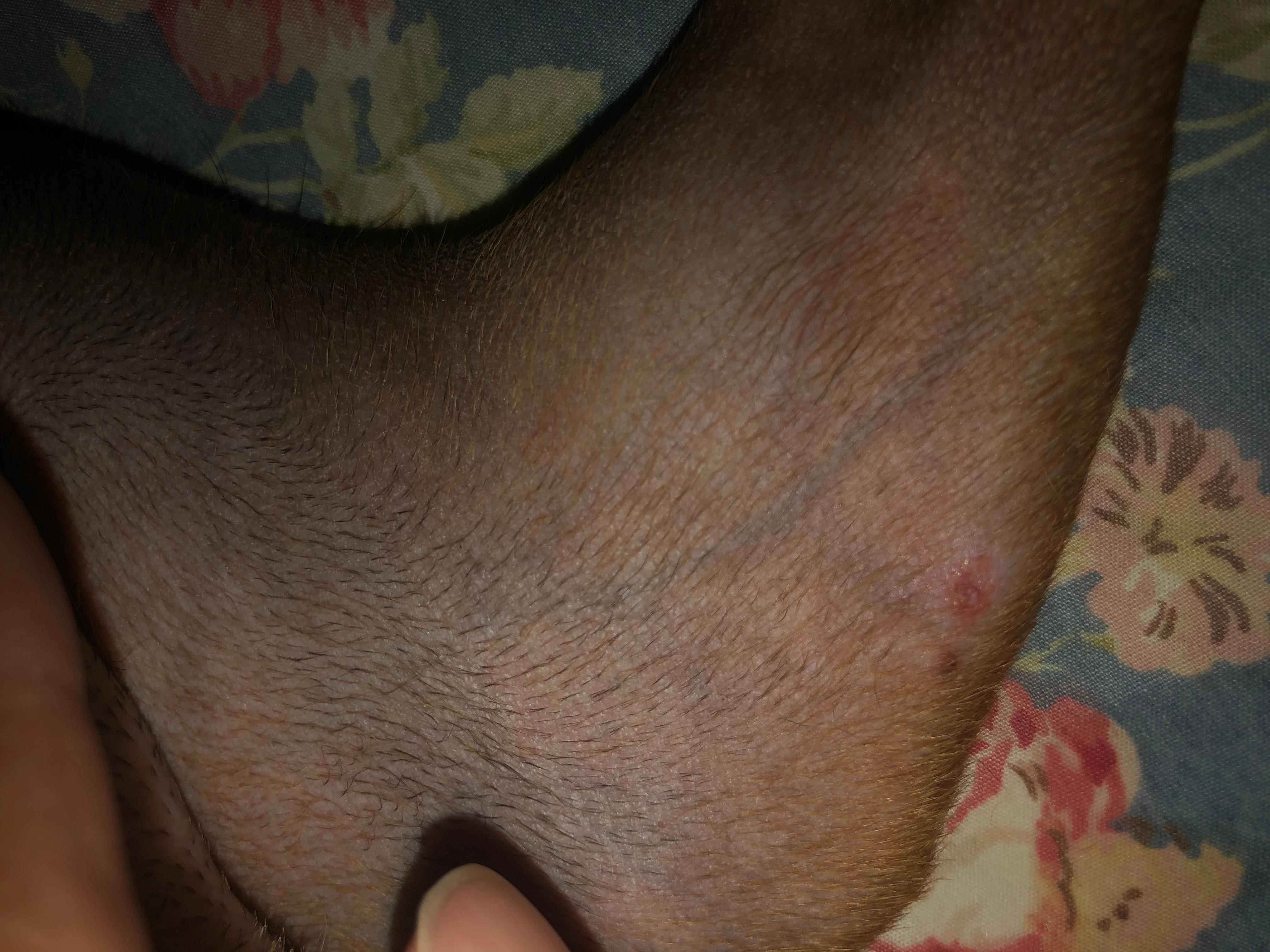 Question details sensitive content