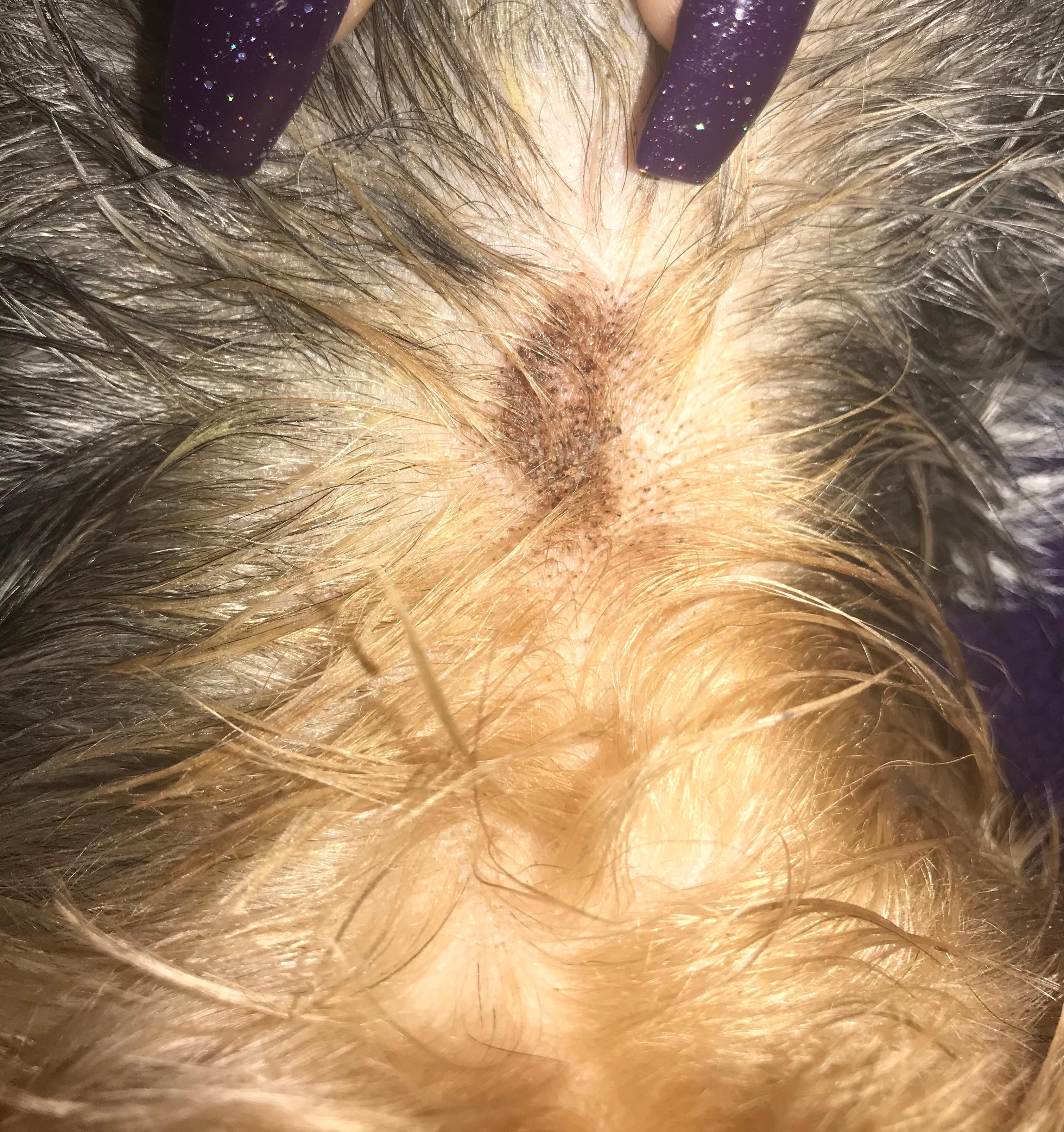 Question details sensitive content