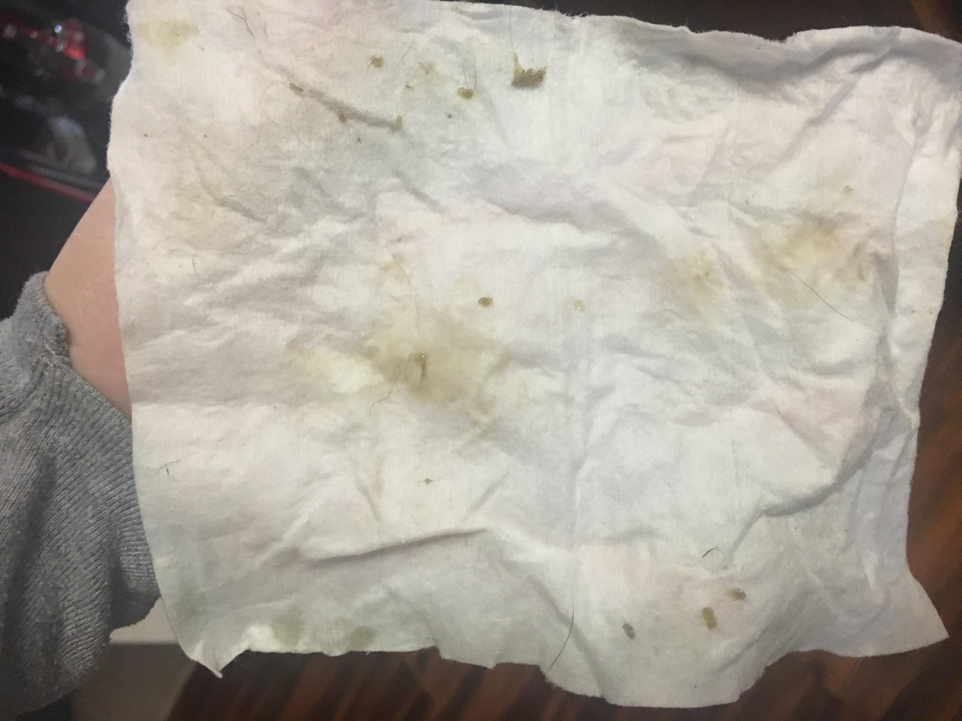 Question details sensitive content