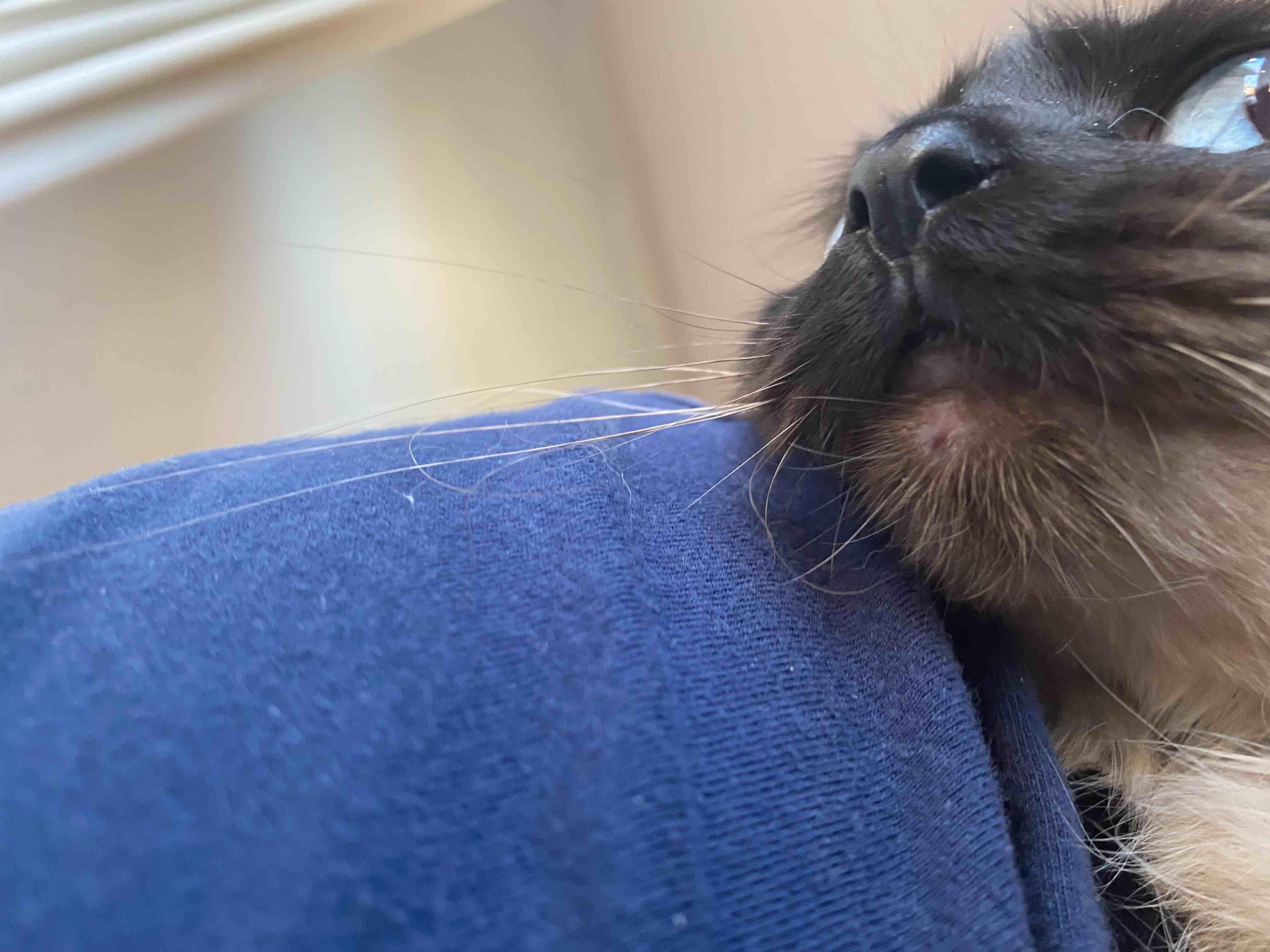 Question details sensitive content